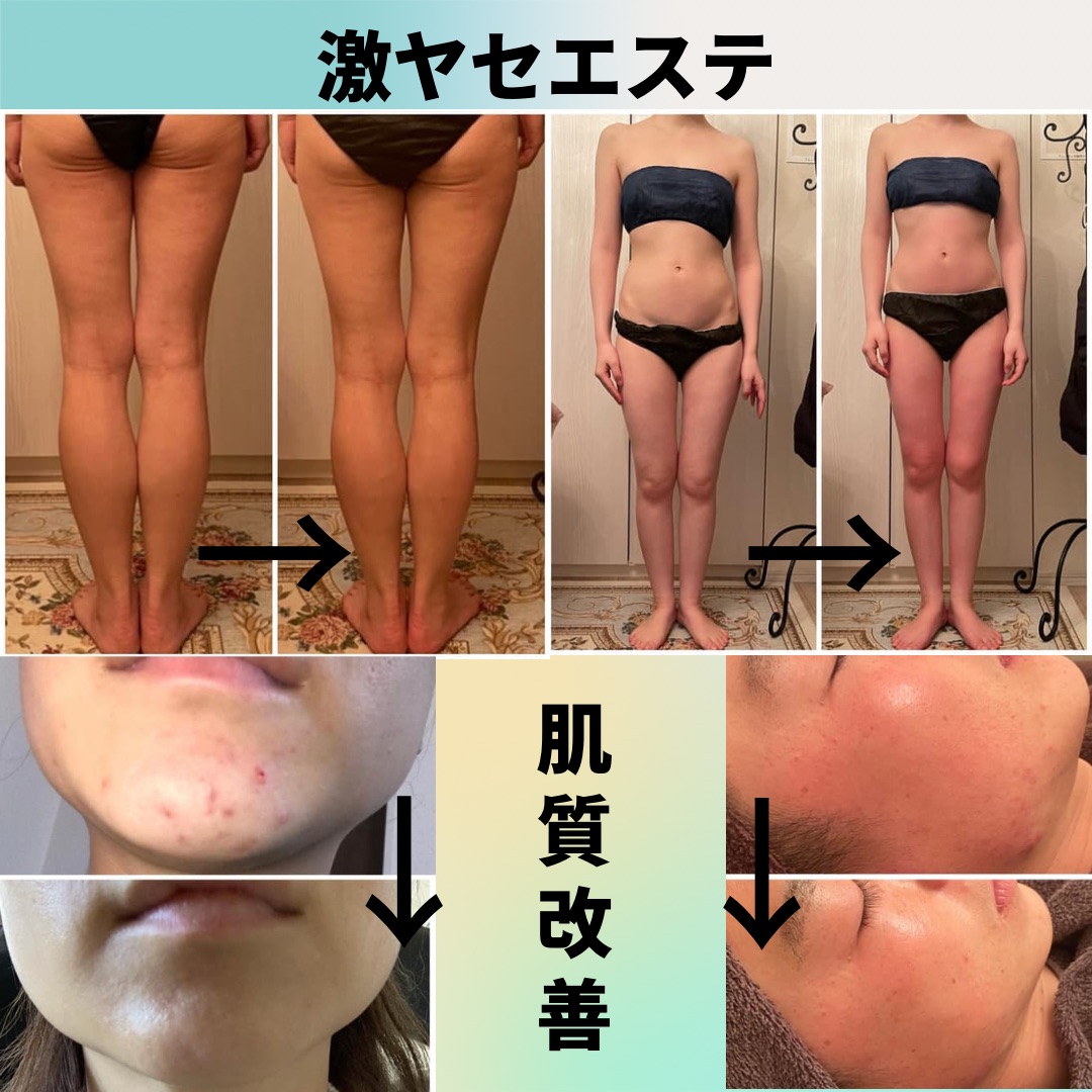 Eclat Jua 断捨離エステ美肌サロン川越のエステ リラクサロン エステティシャン セラピスト情報 美ボディ痩身 肌育成 Eclat Jua ミニモ