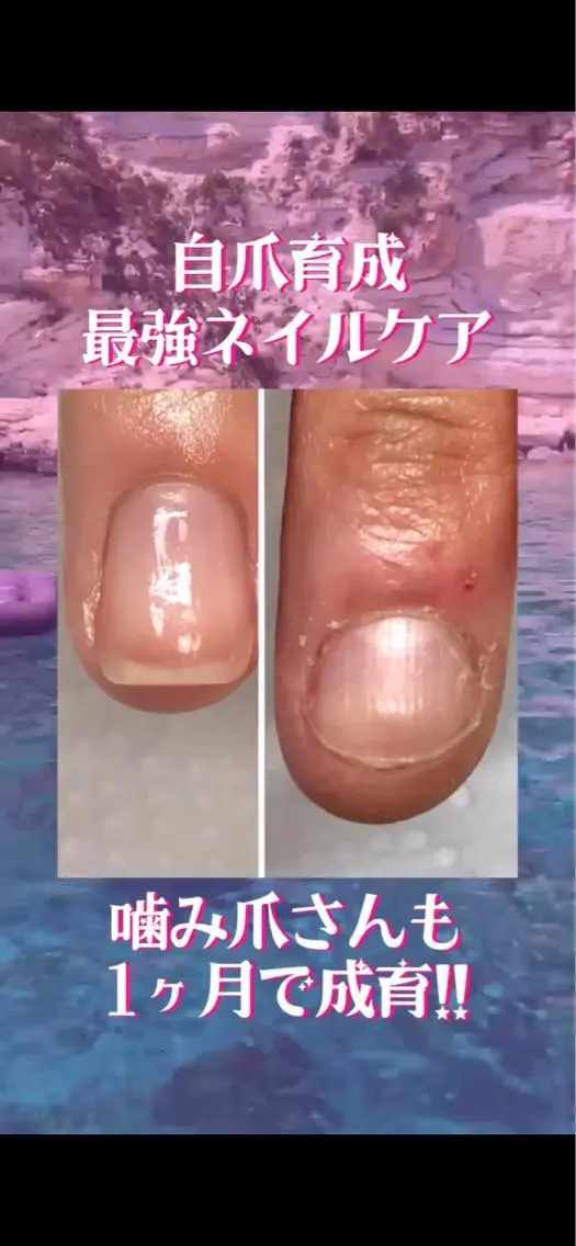 ネイル その他(ネイル) 自爪育成ネイルサロン Pause(ポーズ)のネイルデザイン