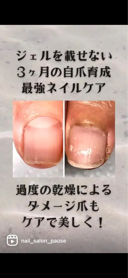 ネイル その他(ネイル) 自爪育成ネイルサロン Pause(ポーズ)のネイルデザイン