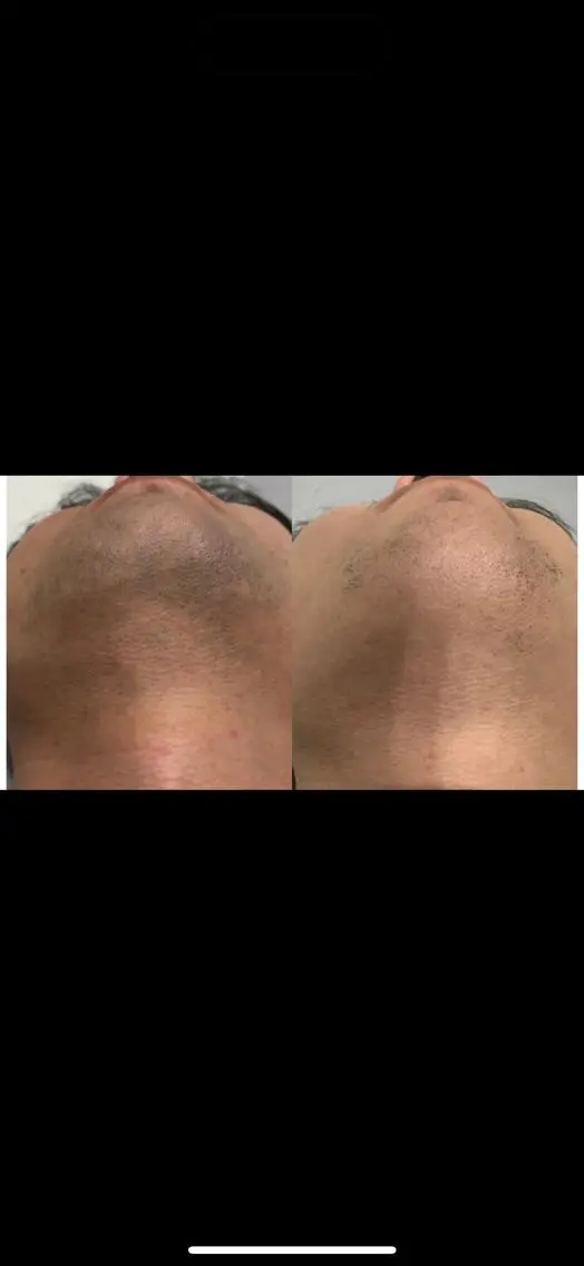 メンズ 脱毛 【脱毛専門】 REALbeautyのエステ・リラクイメージ