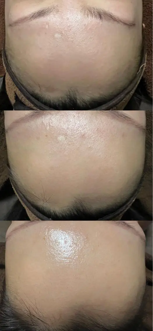 エステ リラク lymph care 'Welnəsのエステ・リラクイメージ