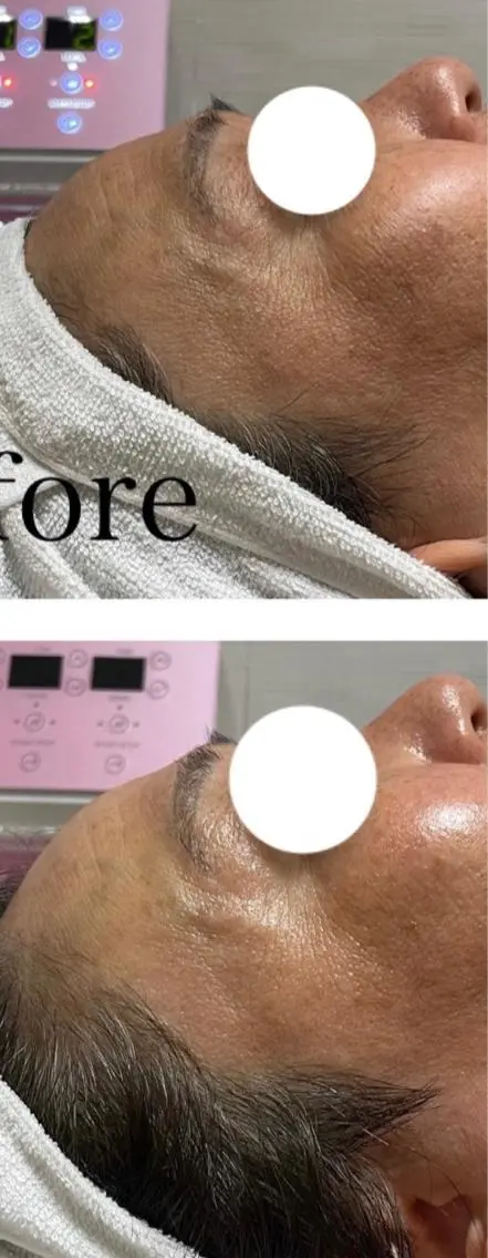 ビューティーサロン B.glossyのネイルデザイン