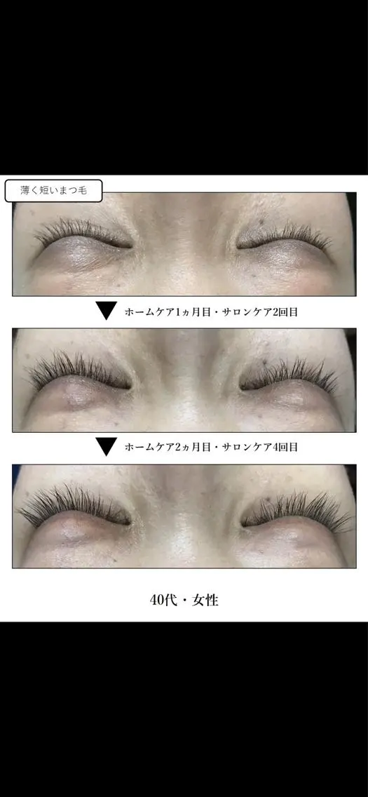 マツエク・マツパ 🧸 Emiri🫧のマツエク・マツパデザイン