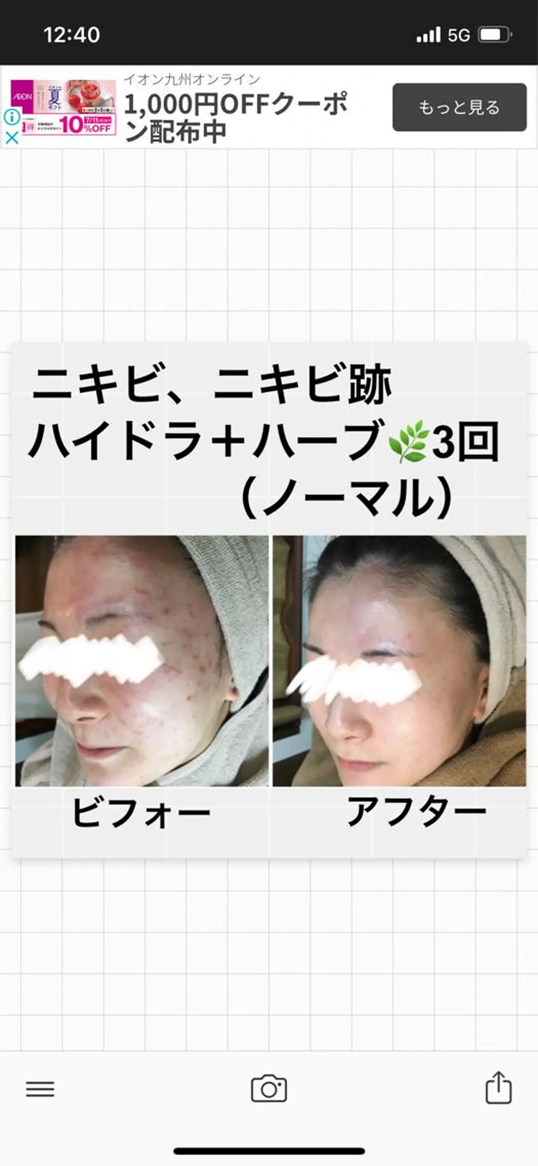 ロング カラー パーマ ヘアアレンジ メンズ キッズ ネイル マツエク・マツパ アイブロウ エステ ハーブピーリング専門 🌿モッカのエステ・リラクイメージ