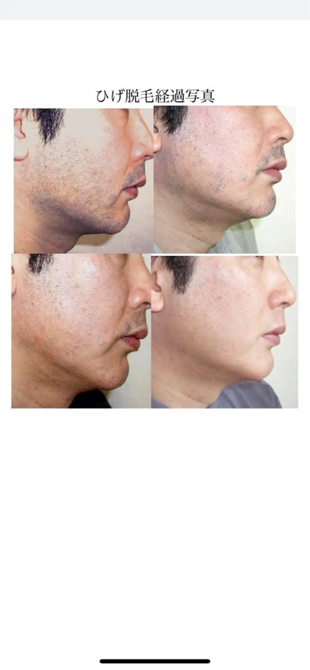 メンズ 脱毛 Lilyboo 池袋のエステ・リラクイメージ