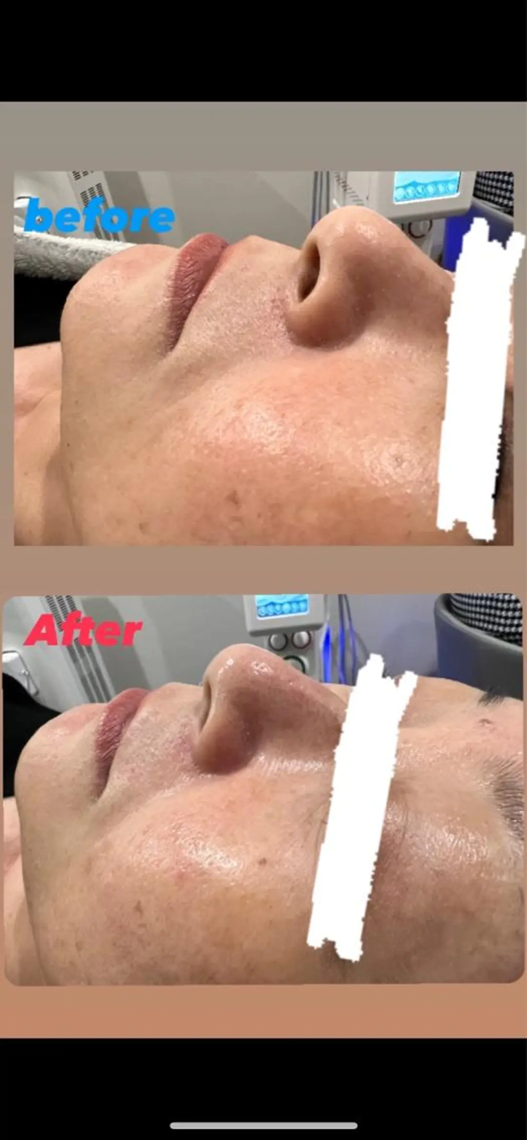 痩身/毛穴洗浄/脱毛 アルカンジュのエステ・リラクイメージ