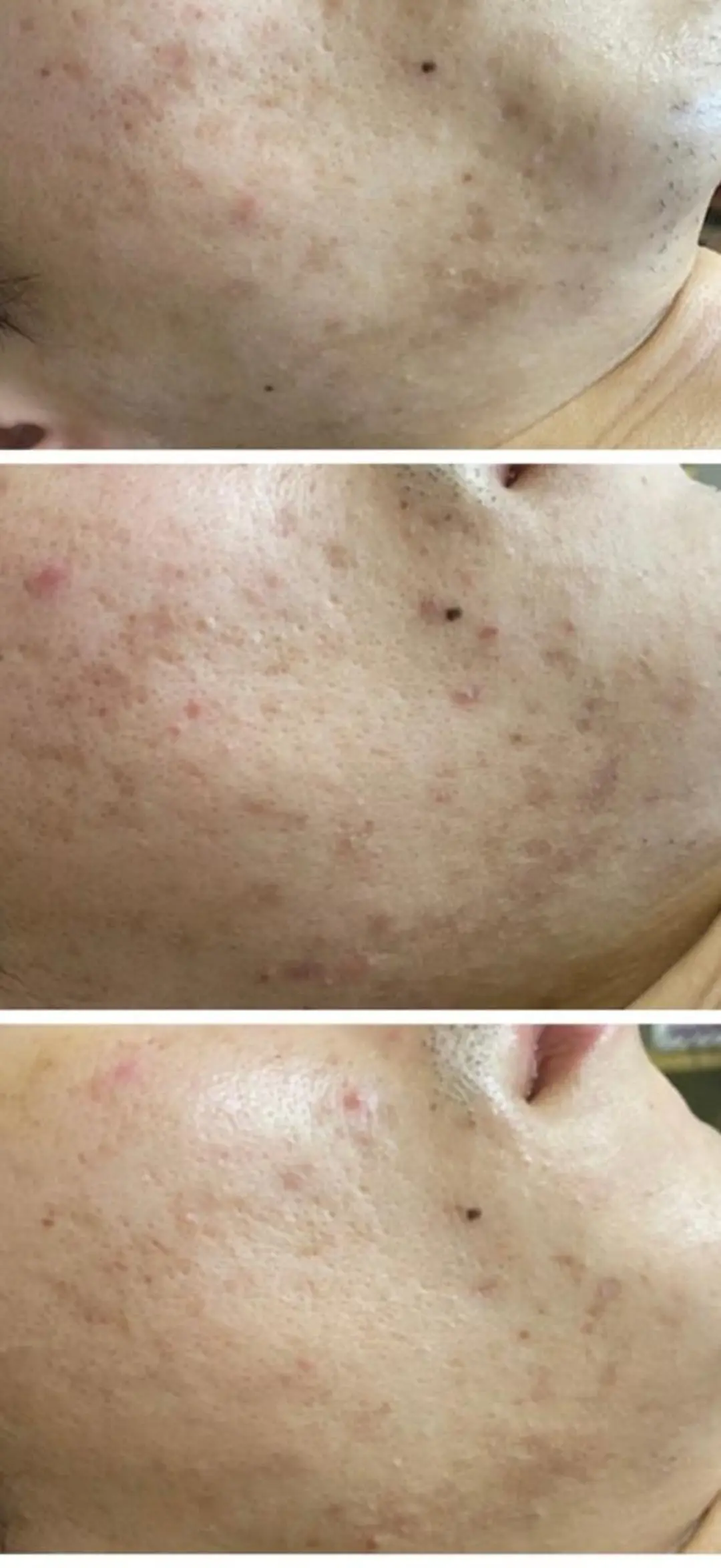 メンズ 朝重い人専用 肩甲骨調整のエステ・リラクイメージ