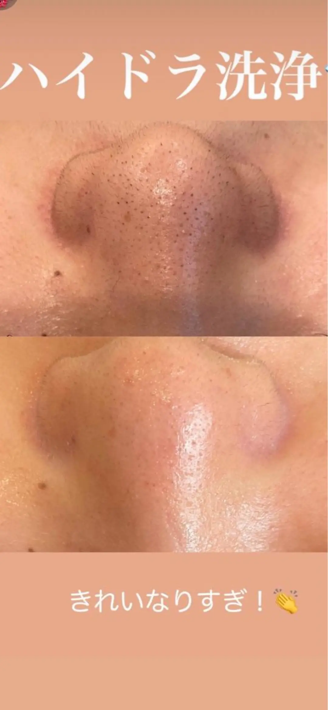 ベルーテ エッセンスのエステ・リラクイメージ