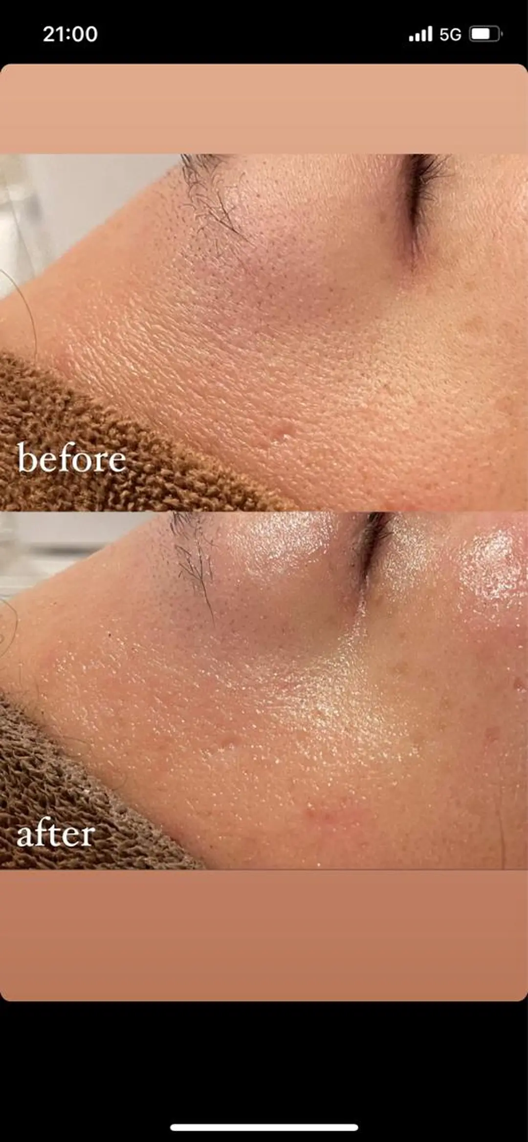 メンズ La・Bellvie所属・La･Bellvie 【星ヶ丘店]のエステ・リラクイメージ