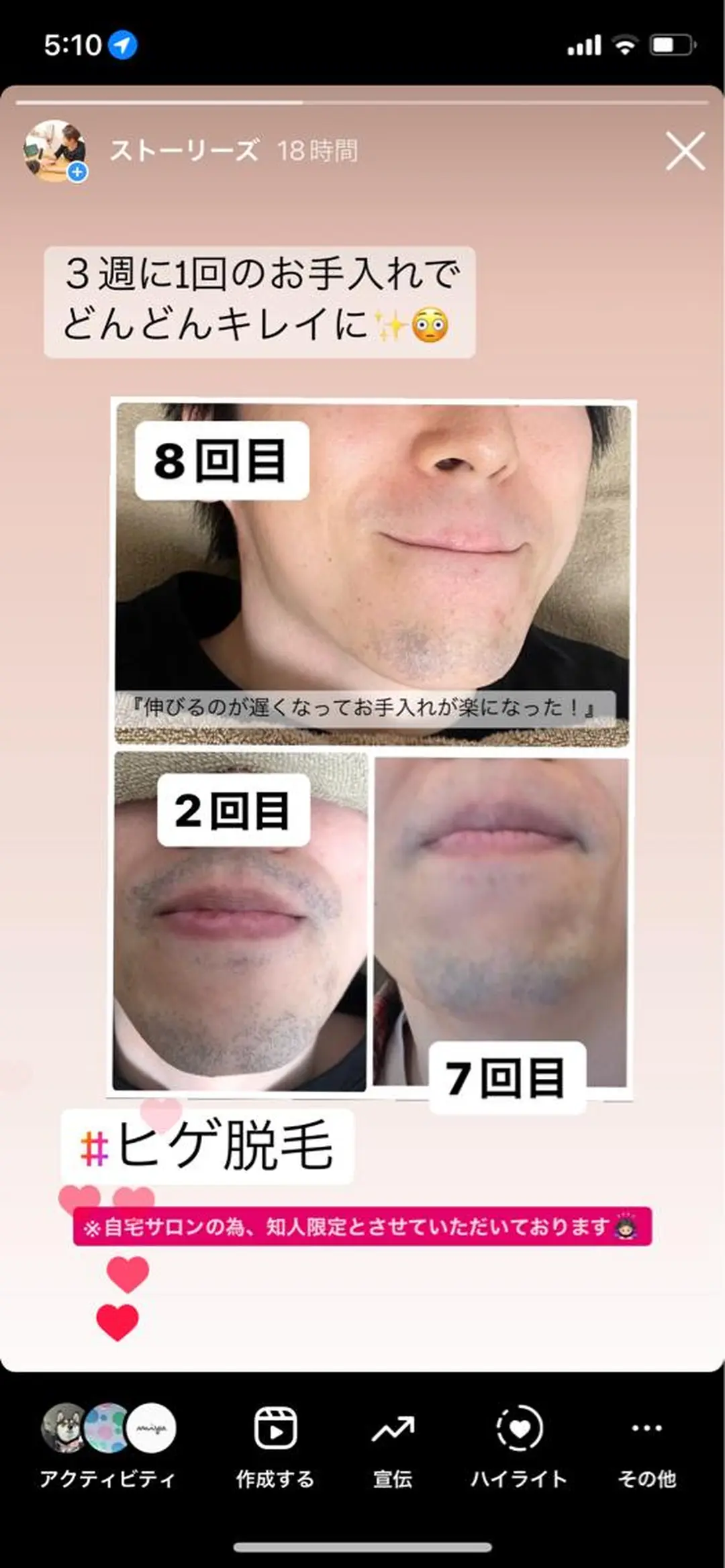 メンズ 女性専用脱毛サロン エンジェルナンバーのエステ・リラクイメージ