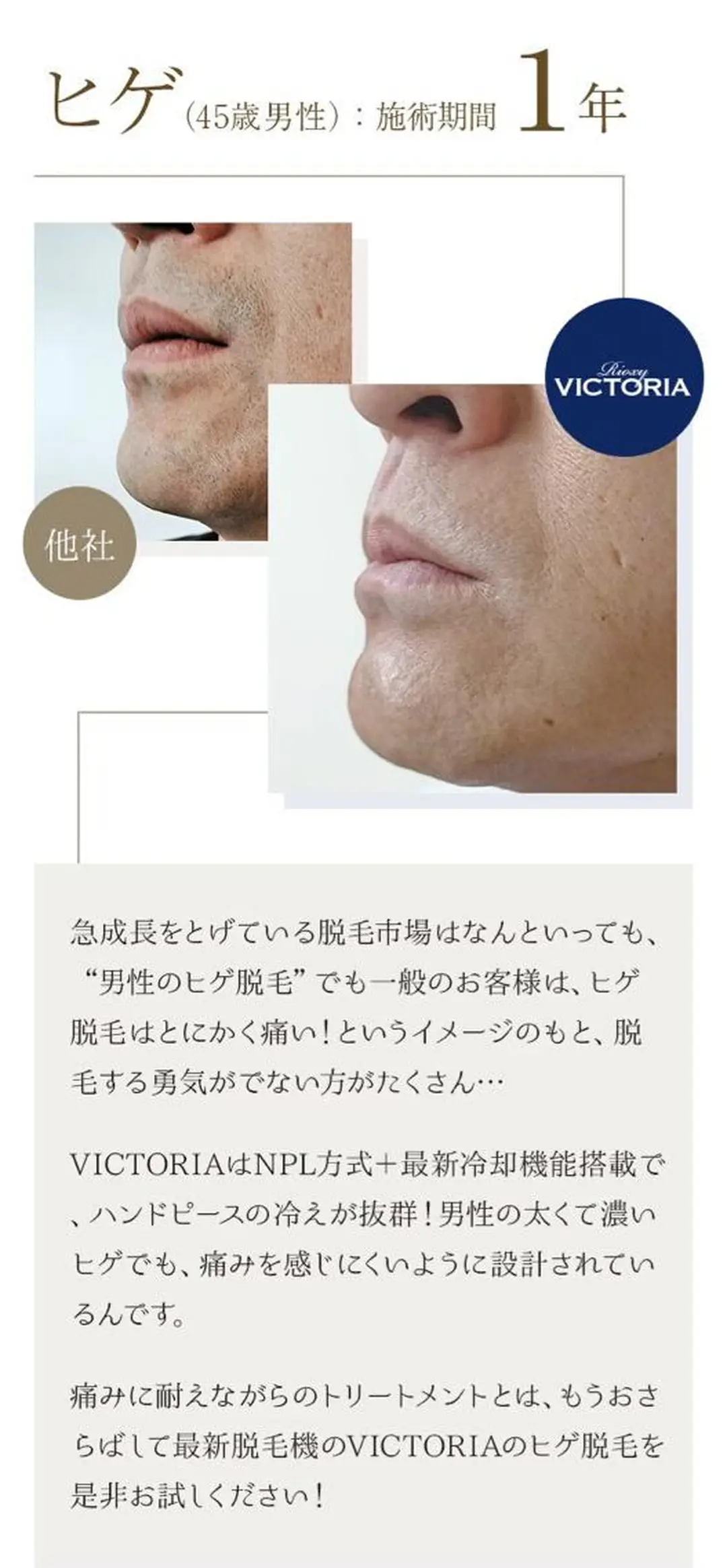 Butterfly 津田沼店 松井のエステ・リラクイメージ