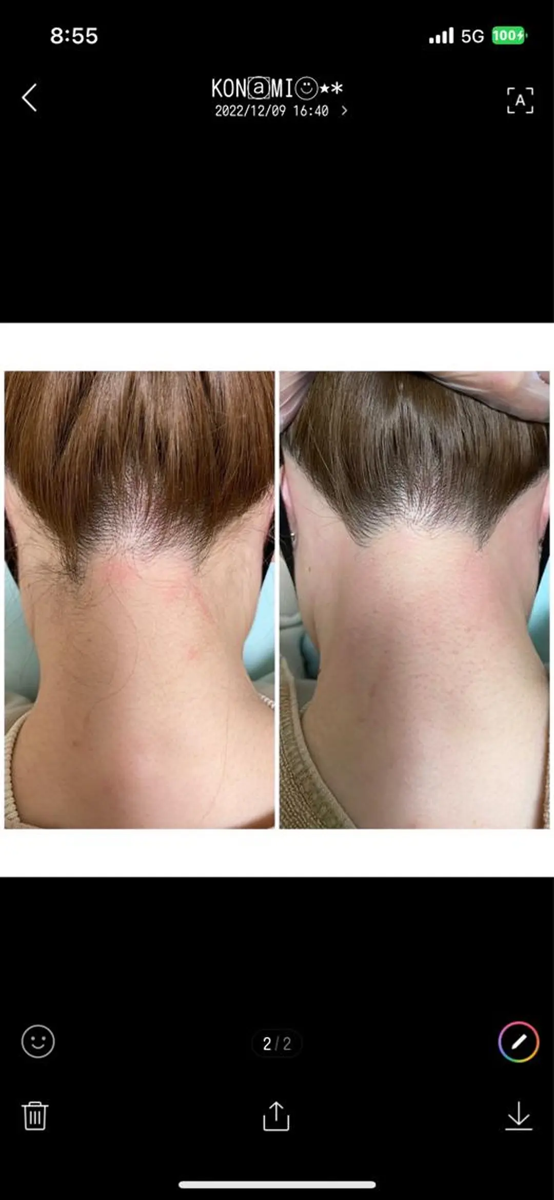 脱毛 エステサロン Mi-mi.iのエステ・リラクイメージ