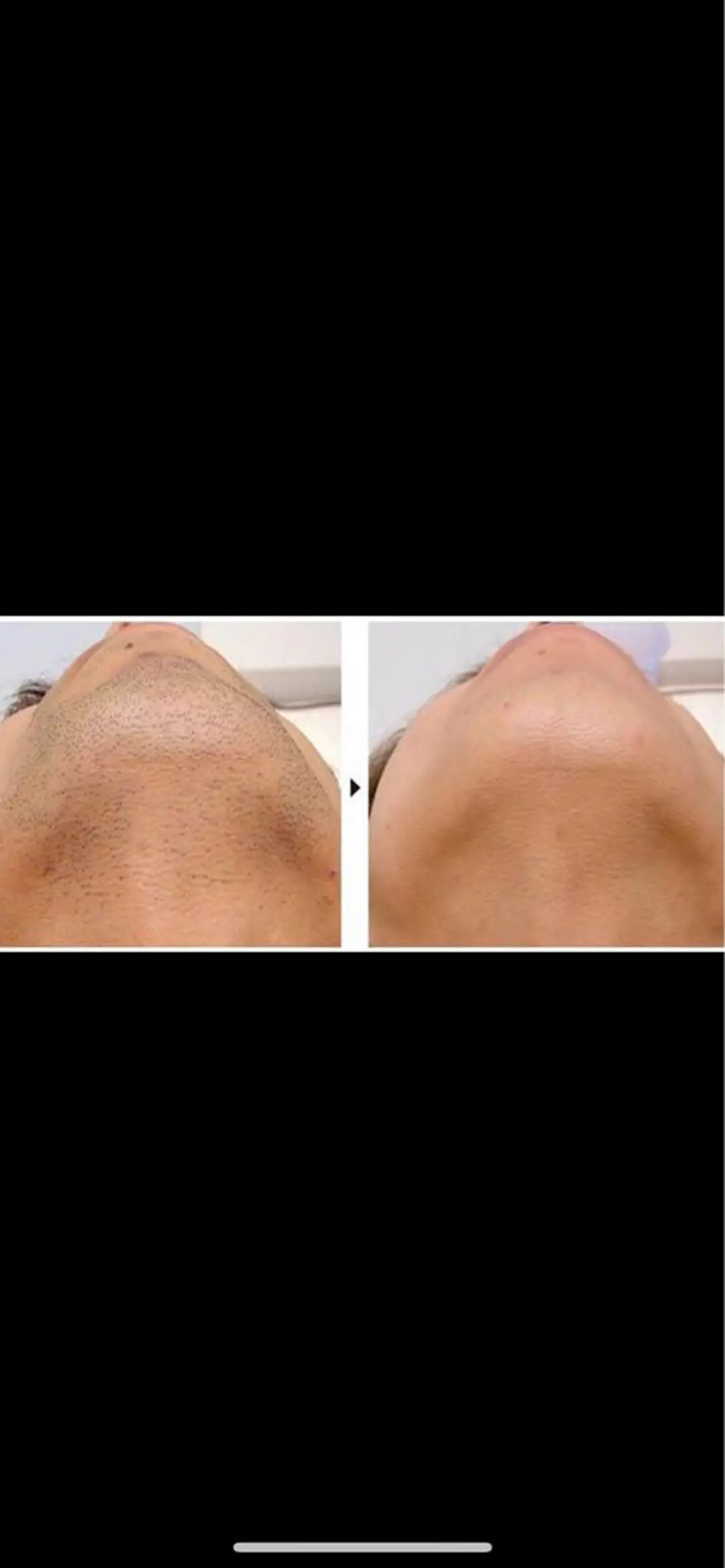 メンズ ecia 脱毛/豊田/浄水のエステ・リラクイメージ