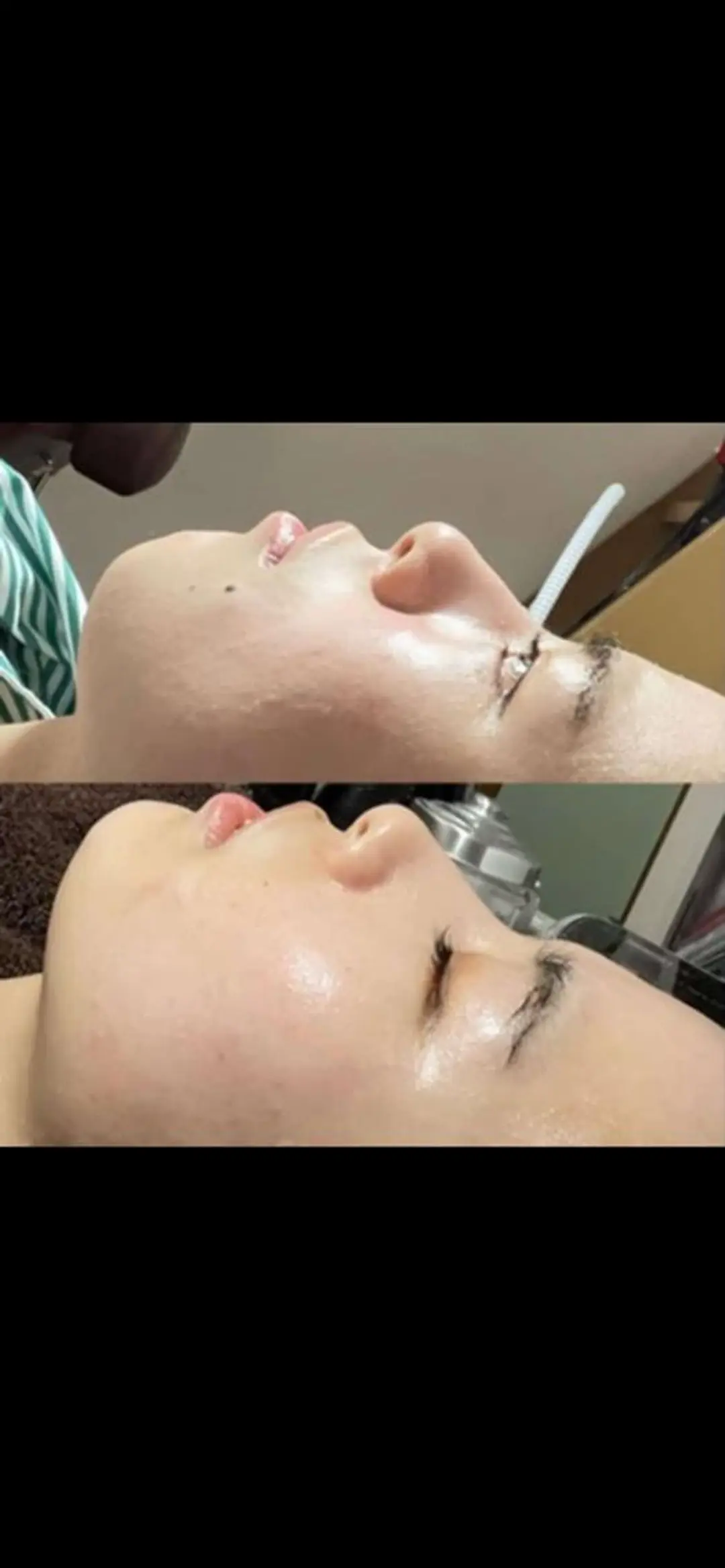 【肌質改善・腸揉み】 Nico laughのエステ・リラクイメージ