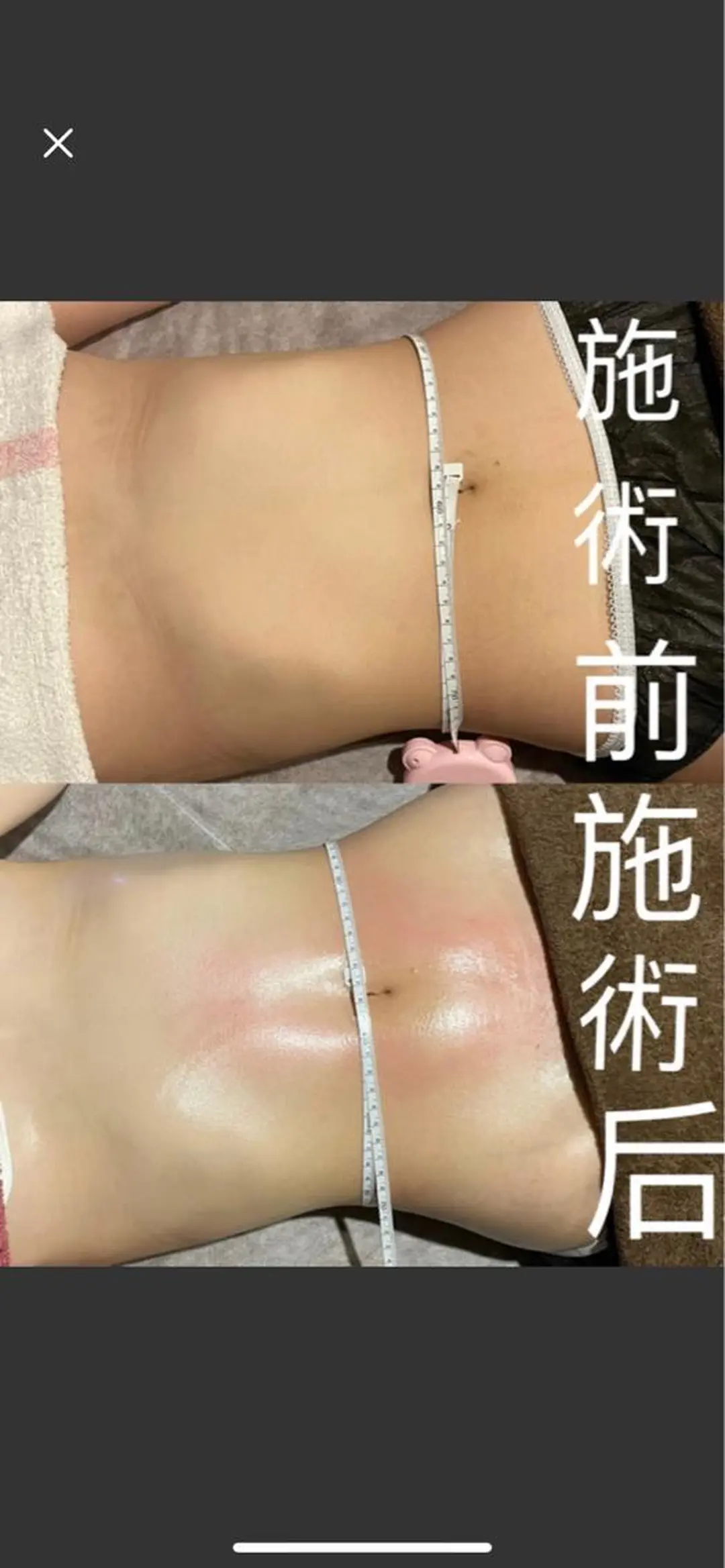 ショート ランベリ ランベリのエステ・リラクイメージ