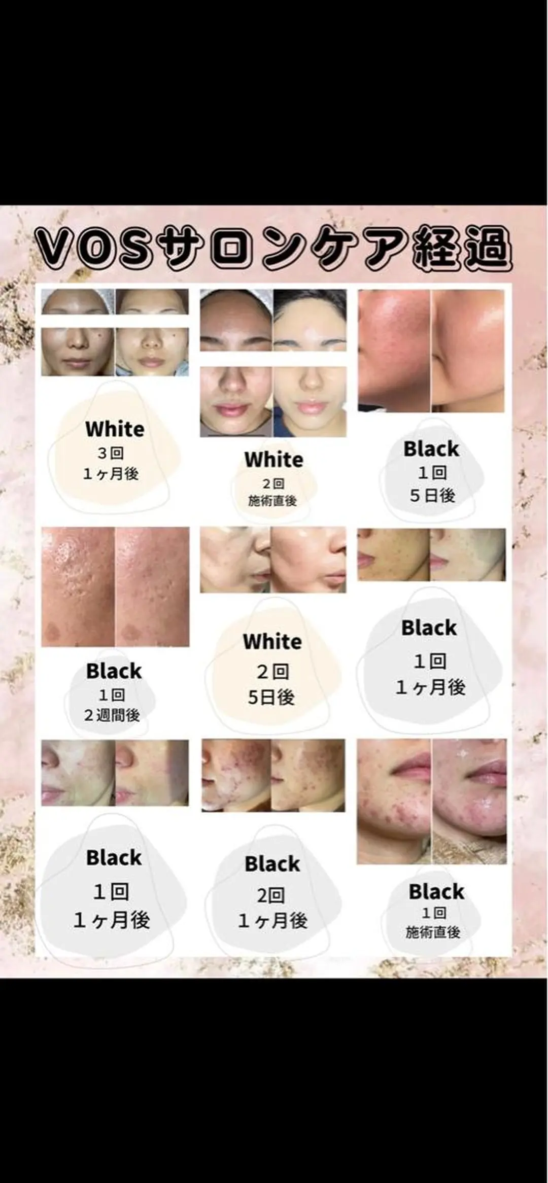 エステサロン Mi-mi.iのエステ・リラクイメージ