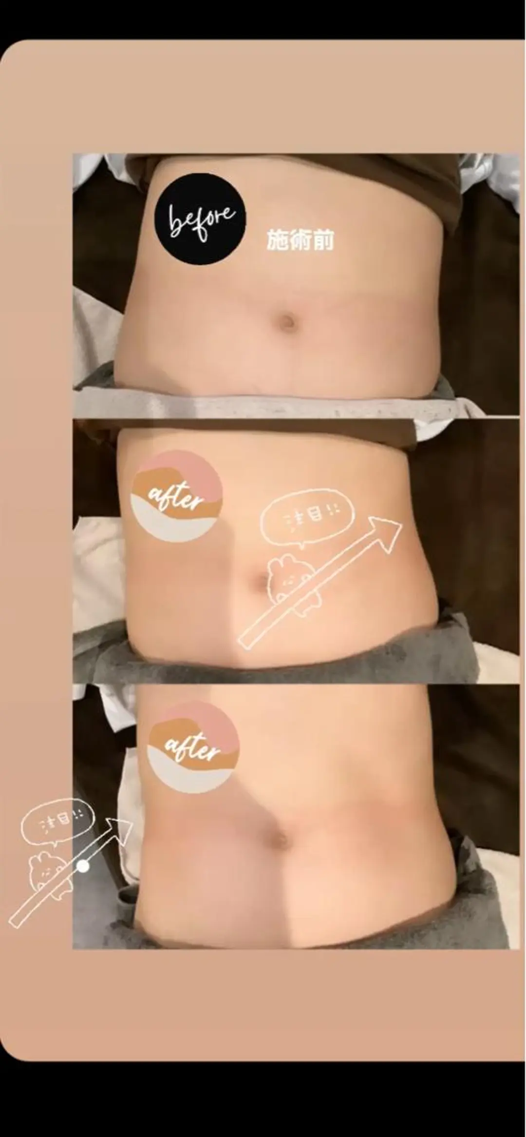 embellie アンベリー所属・アン ベリーのエステ・リラクイメージ