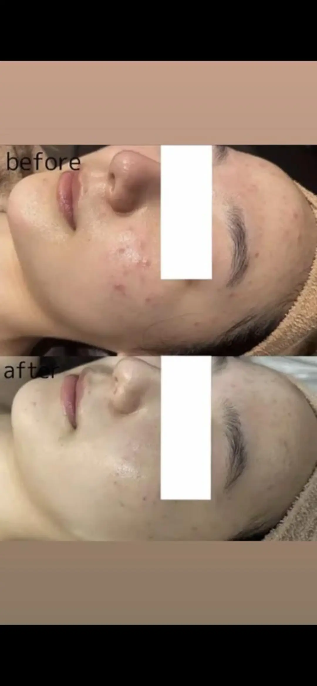 エステ リラク 🌰RAYVIS KURI🐹のエステ・リラクイメージ