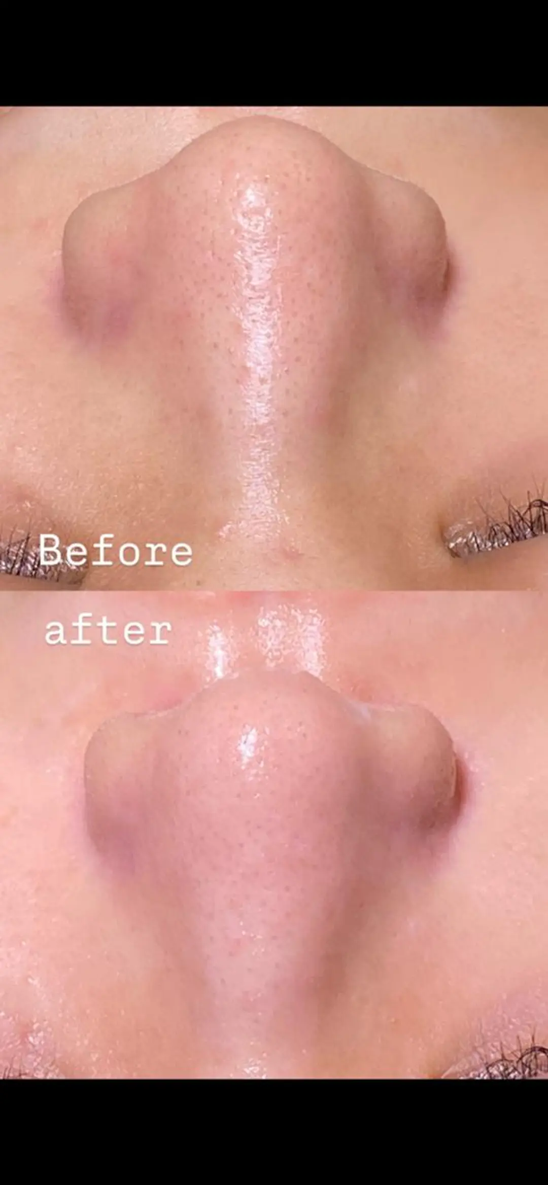 村松/ 小顔,ボディケアのエステ・リラクイメージ