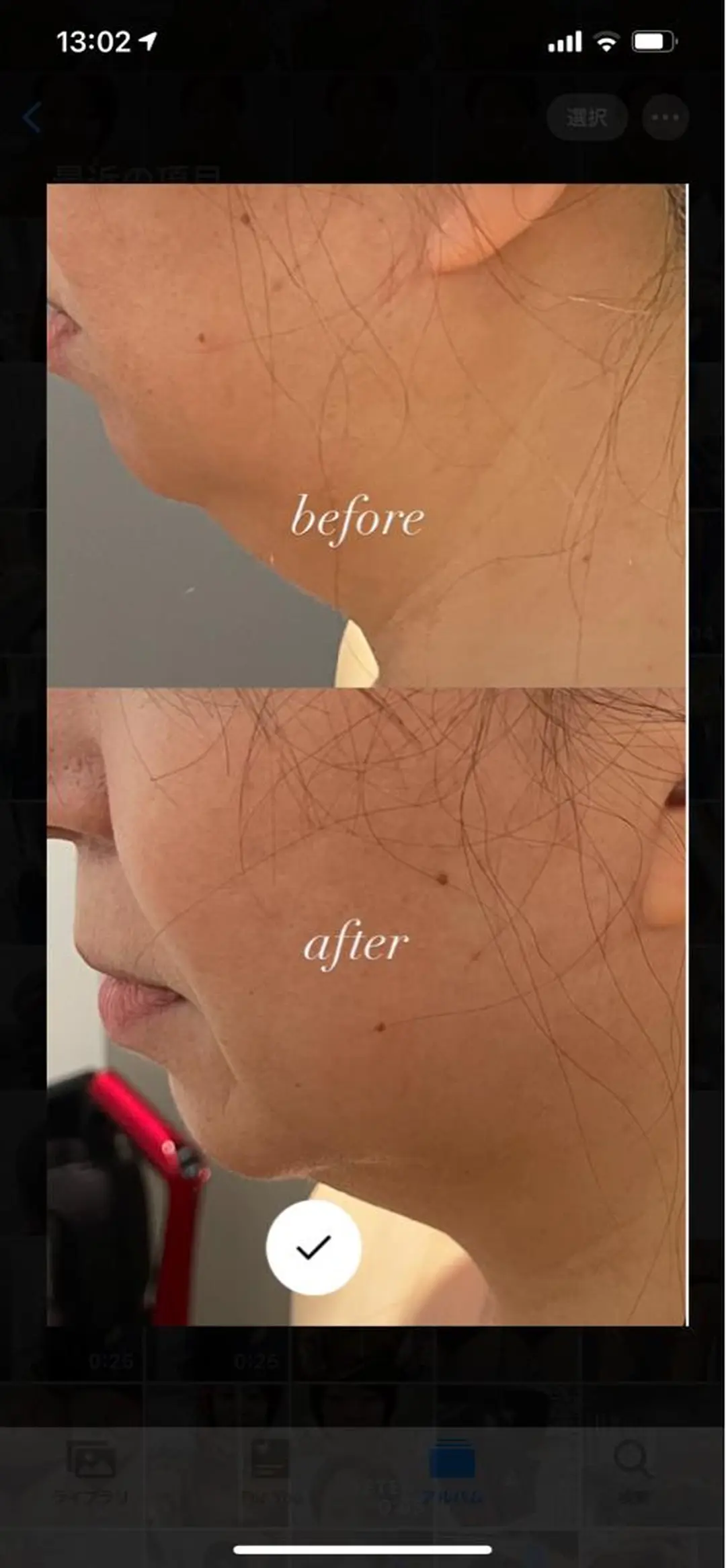 アン ベリーのエステ・リラクイメージ