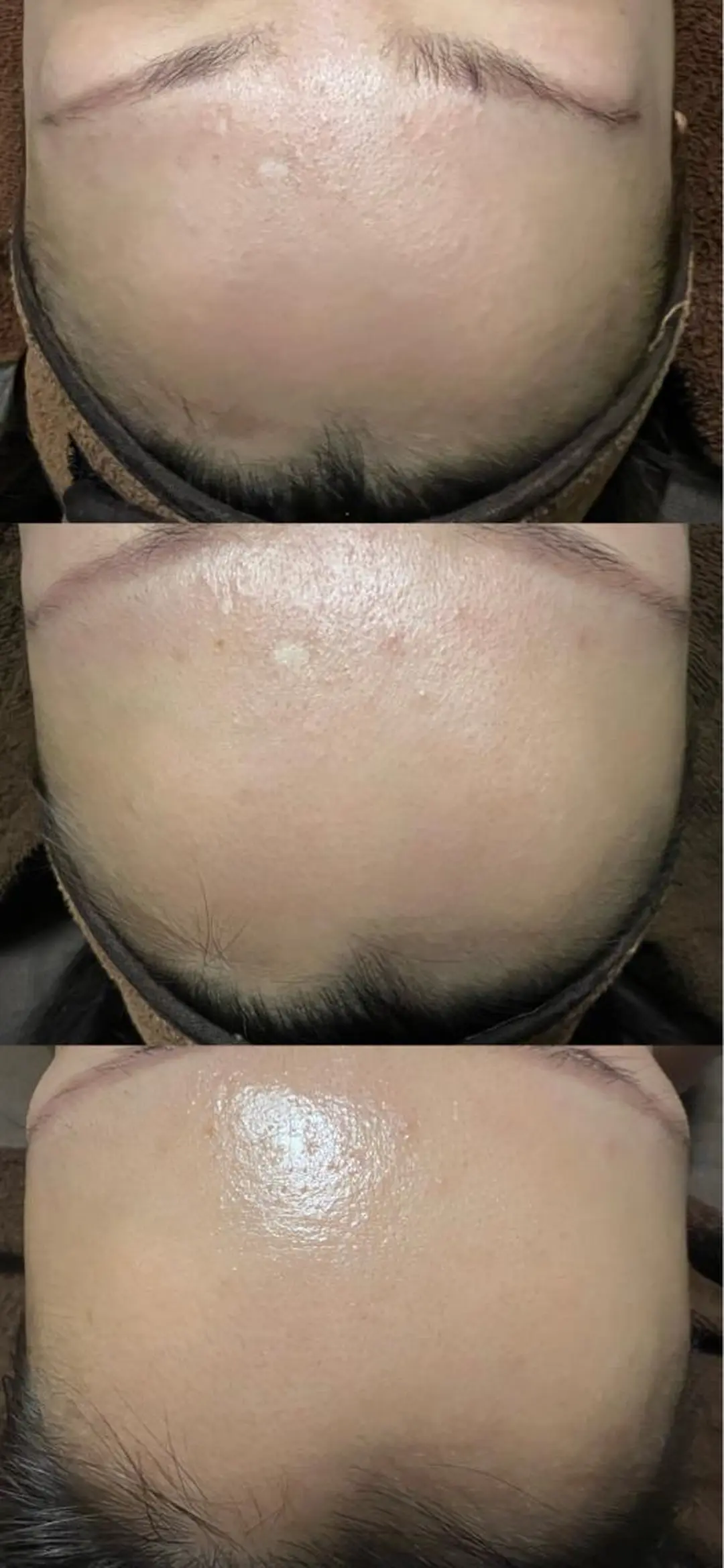 エステ リラク lymph care 'Welnəsのエステ・リラクイメージ