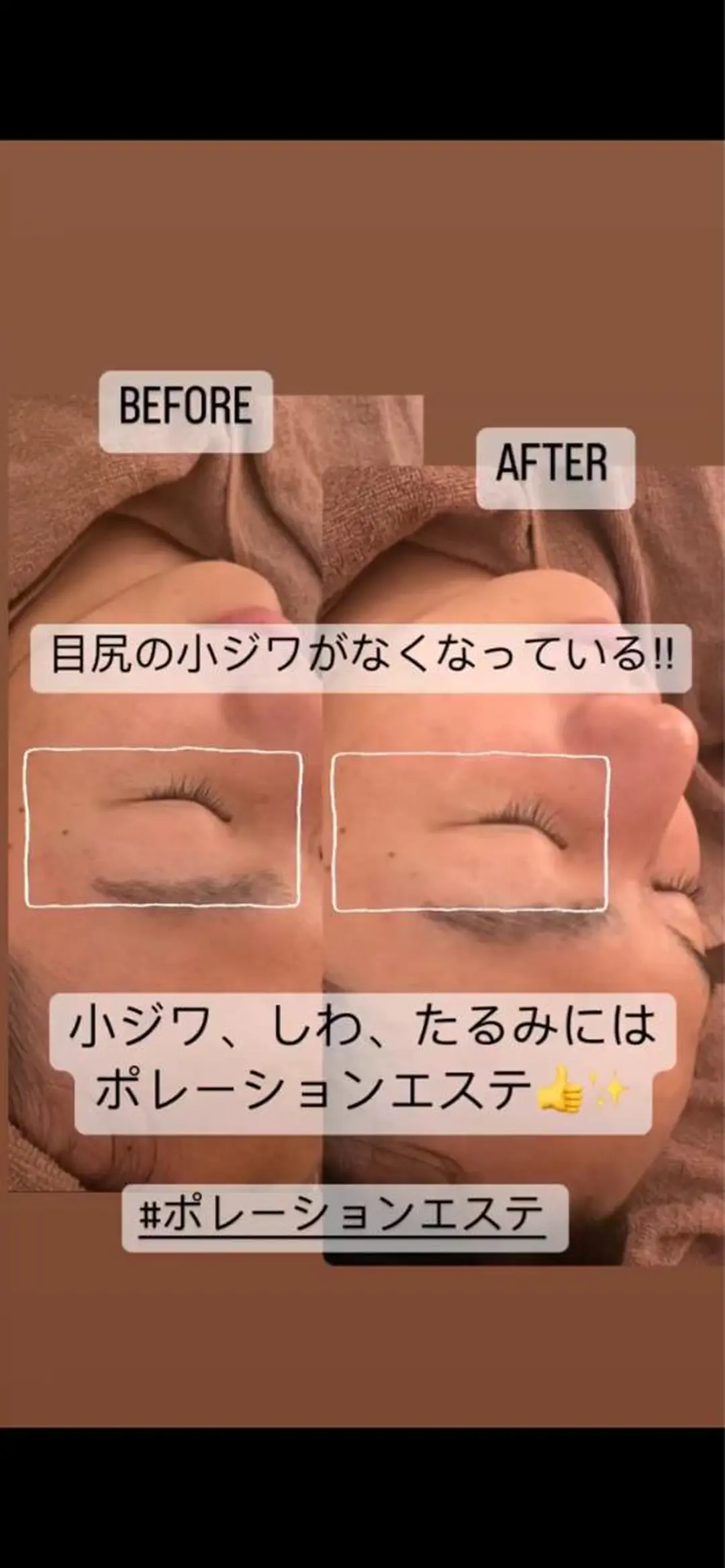 I. Ayaのエステ・リラクイメージ