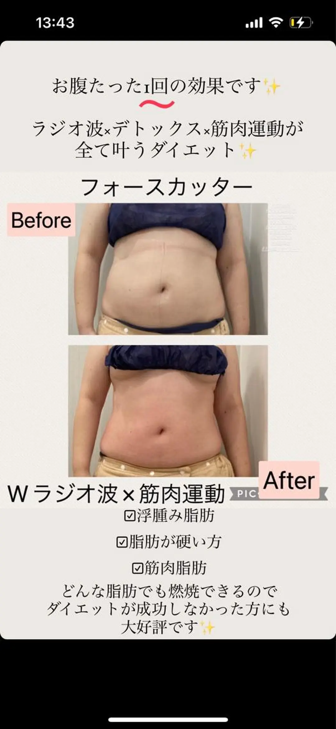 エステ ブライダル痩身×脱毛 尼崎駅前サロンのエステ・リラクイメージ