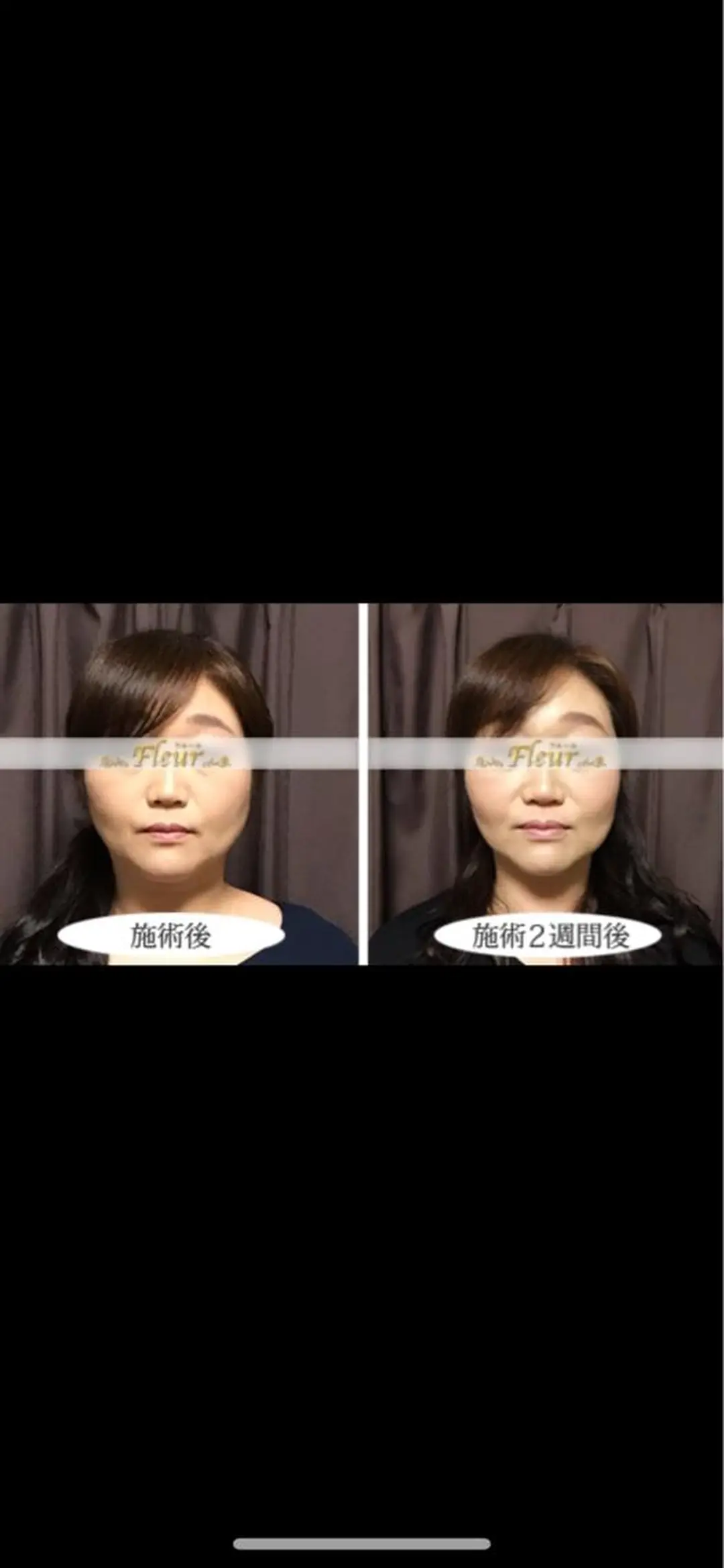 エステ リラク 🍀fleur🍀 杉浦のエステ・リラクイメージ