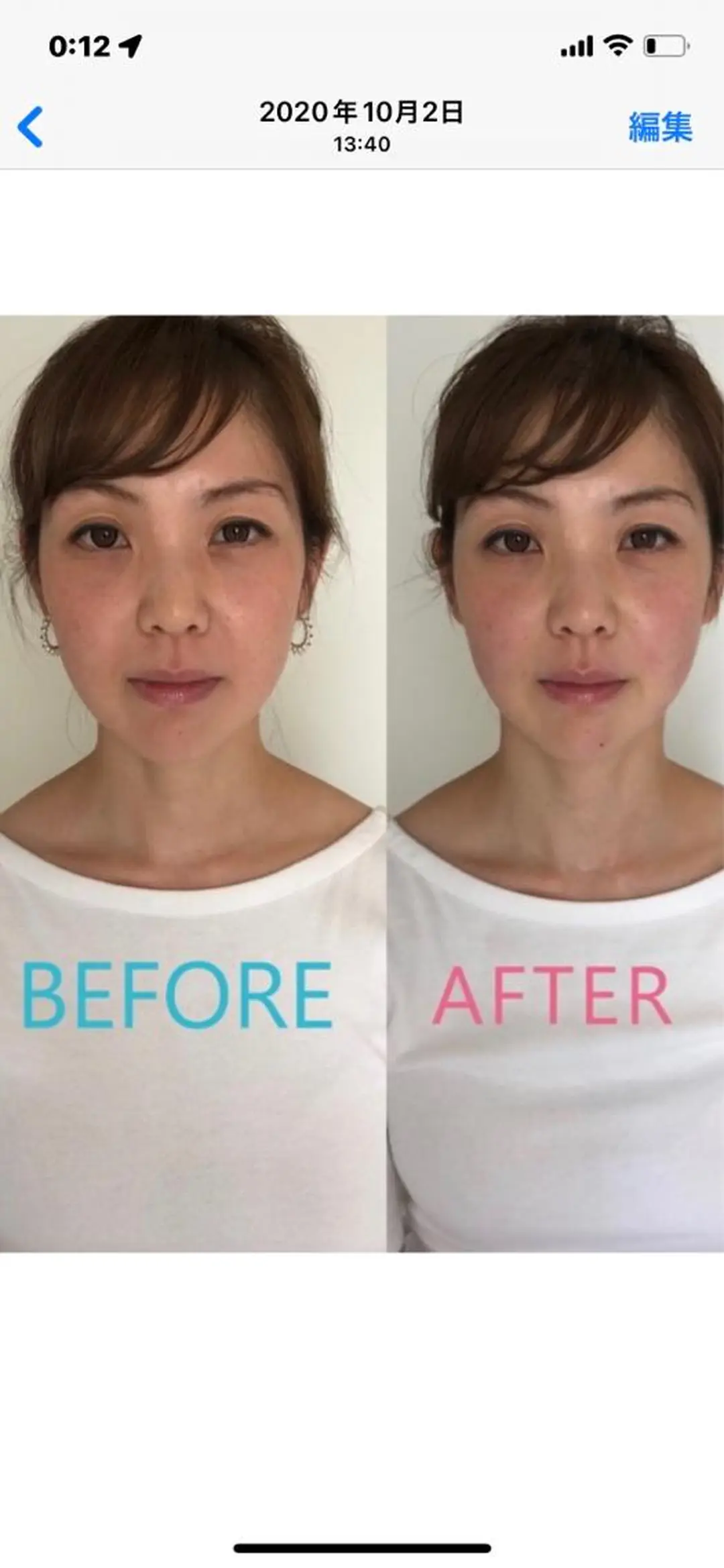 美容鍼灸サロン mahoroba院長のエステ・リラクイメージ