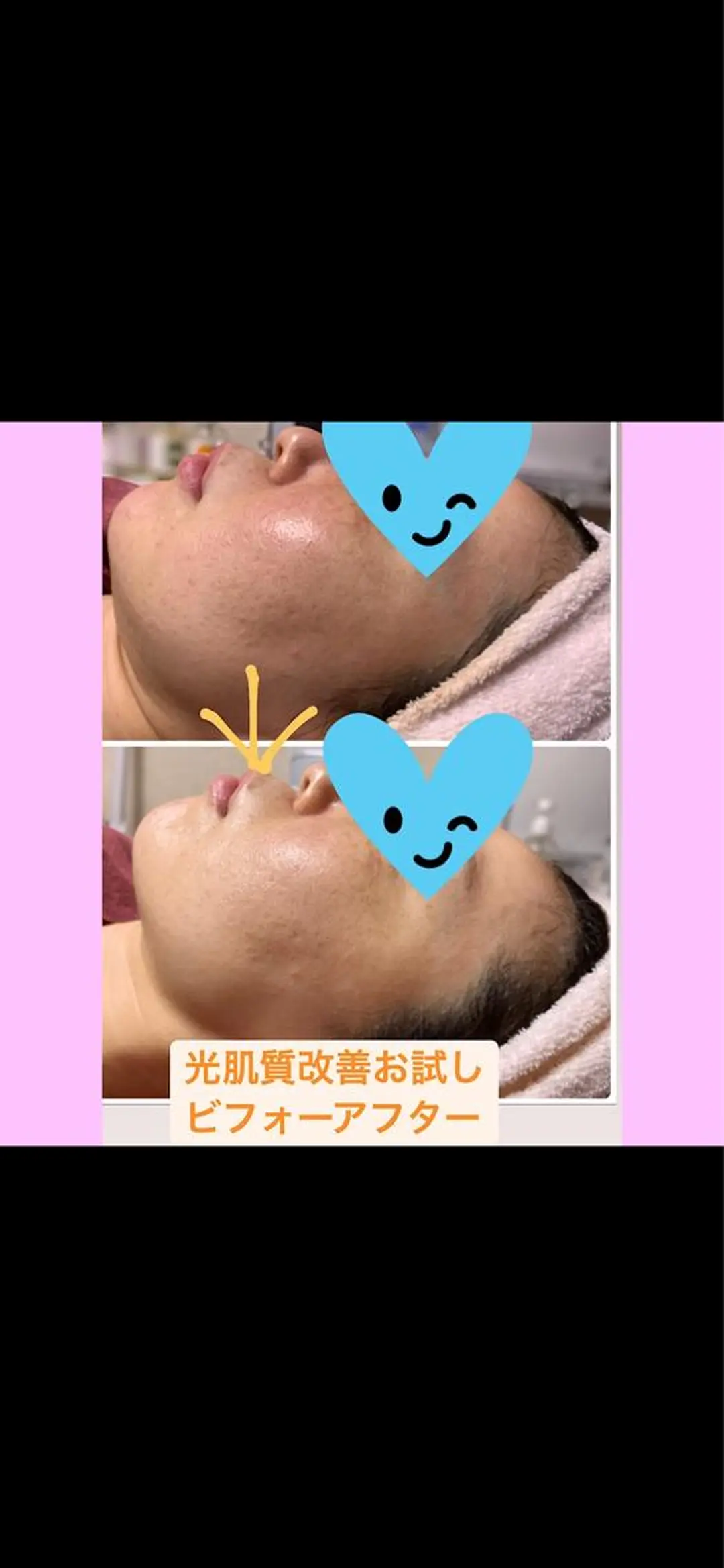 Lien オーナー　山口智嘉のエステ・リラクイメージ