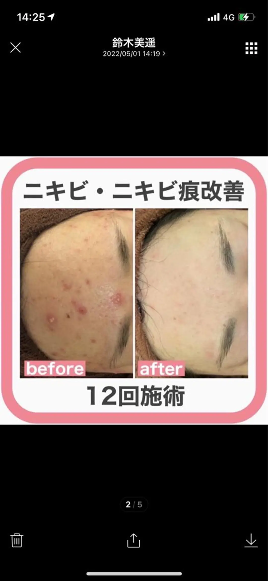 セミロング カラー パーマ ヘアアレンジ メンズ キッズ ネイル マツエク・マツパ アイブロウ ニキビ特化型エステ 🍓最短で肌質改善のエステ・リラクイメージ