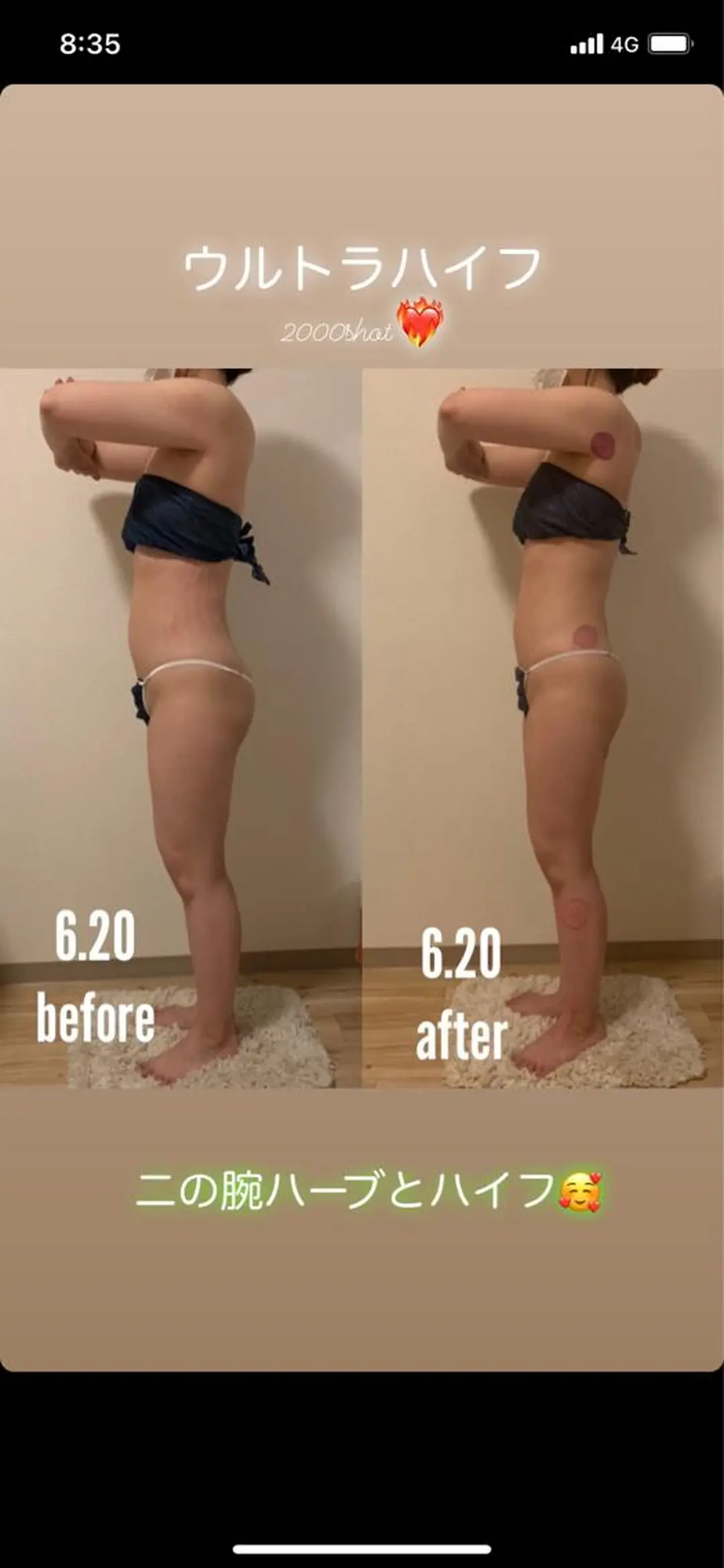 a  room salonのエステ・リラクイメージ