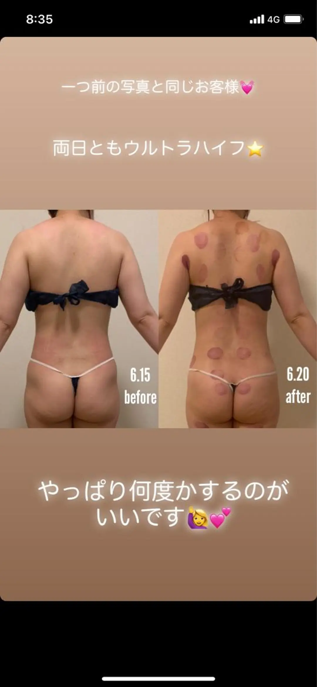 a  room salonのエステ・リラクイメージ