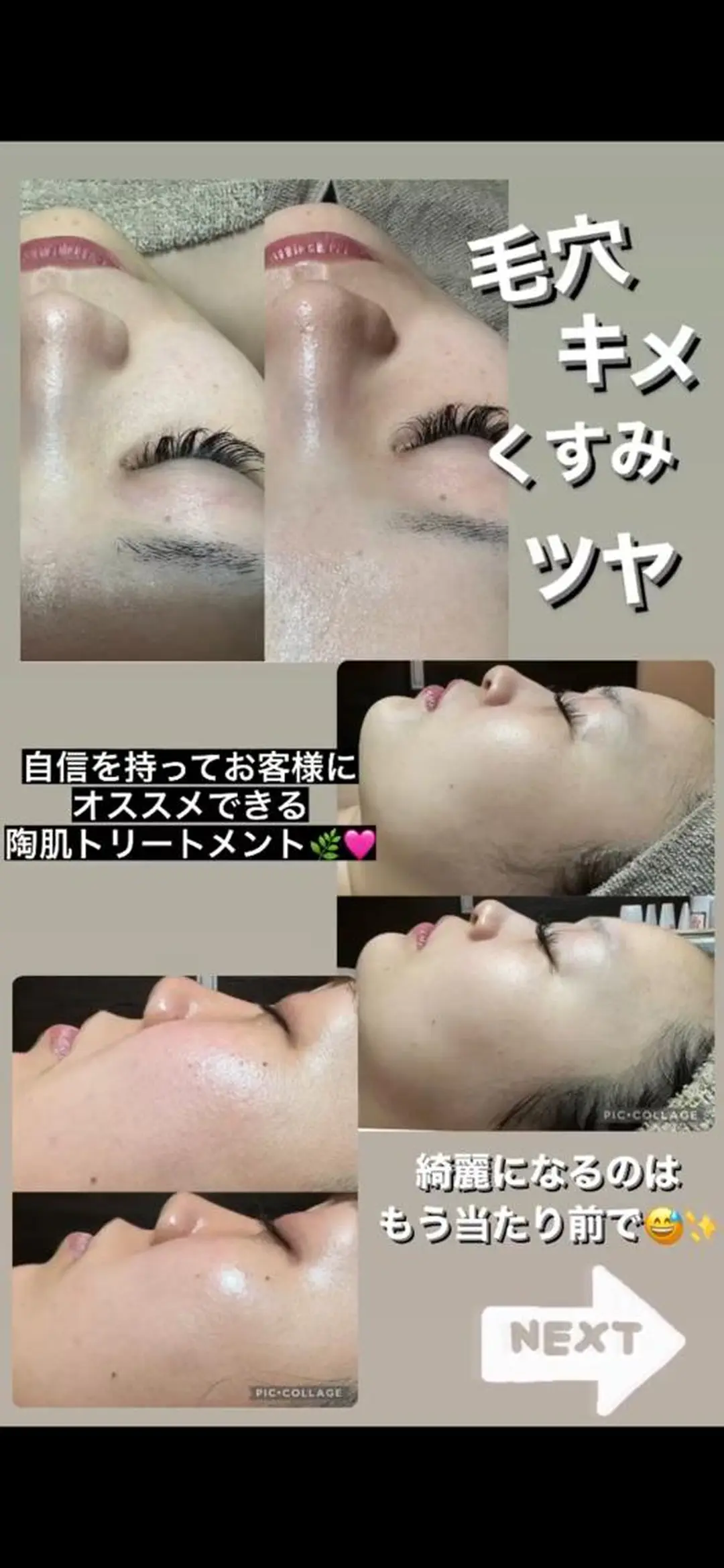 エステ Feel♡ JYURIAのネイルデザイン