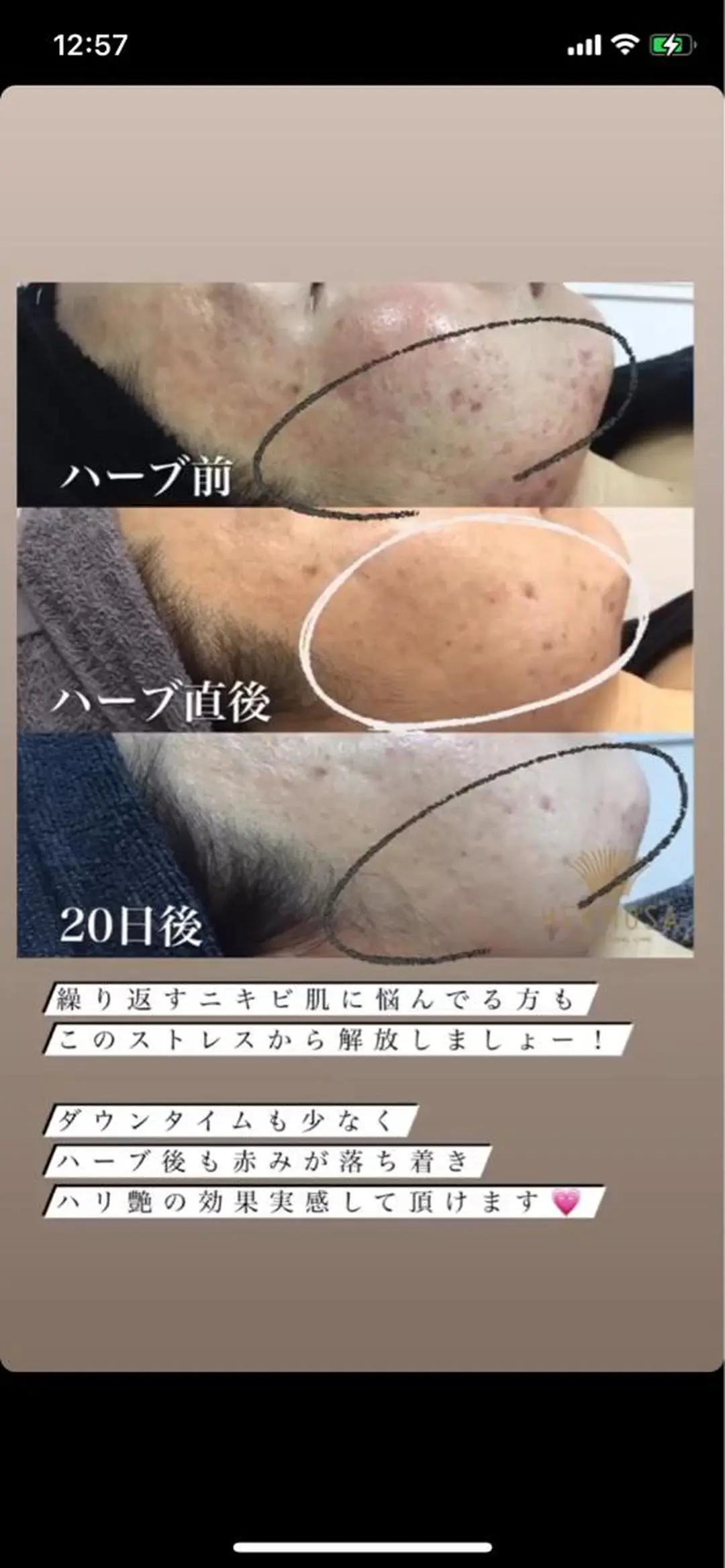 温活未病ケアサロン CoQのエステ・リラクイメージ