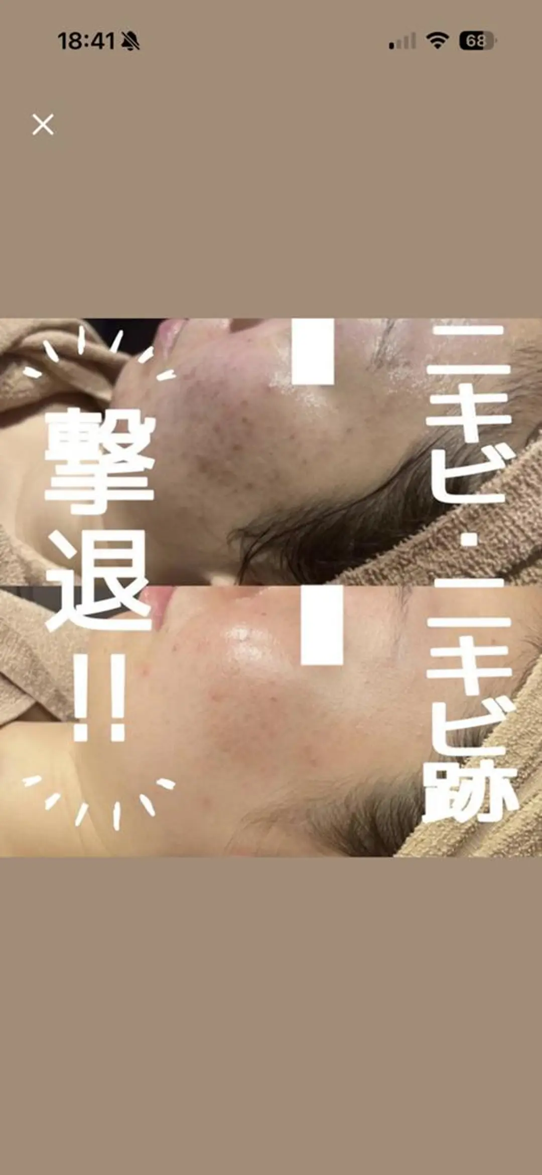 エステ レイビス盛岡店 ♥佐藤♥のエステ・リラクイメージ