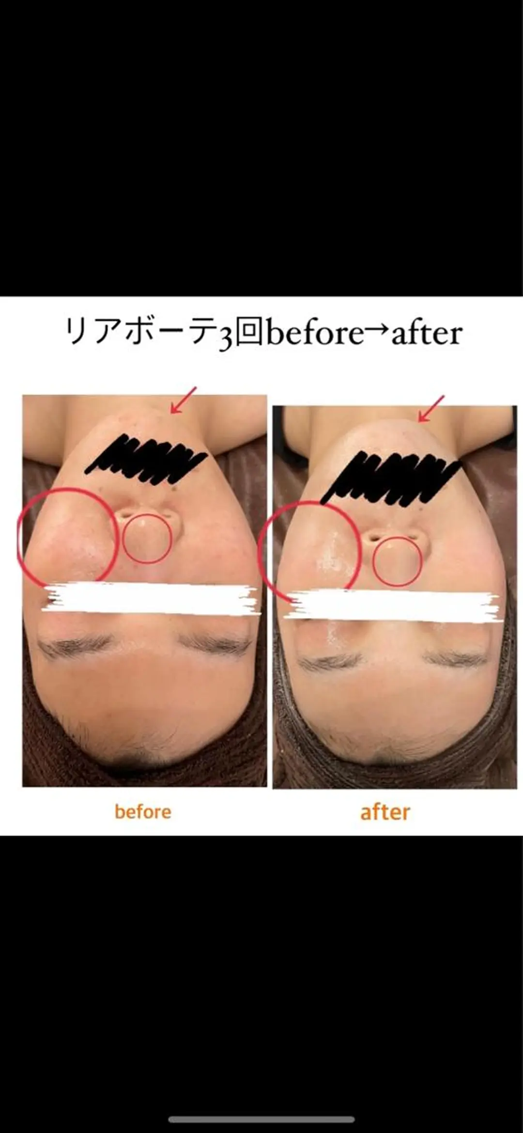 メンズ エステ 肌改善/まつげパーマ 🌙Luunaのエステ・リラクイメージ