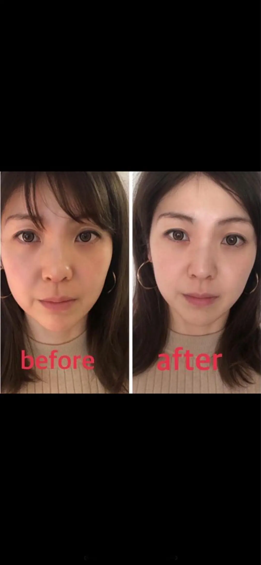 美容鍼灸サロン mahoroba院長のエステ・リラクイメージ