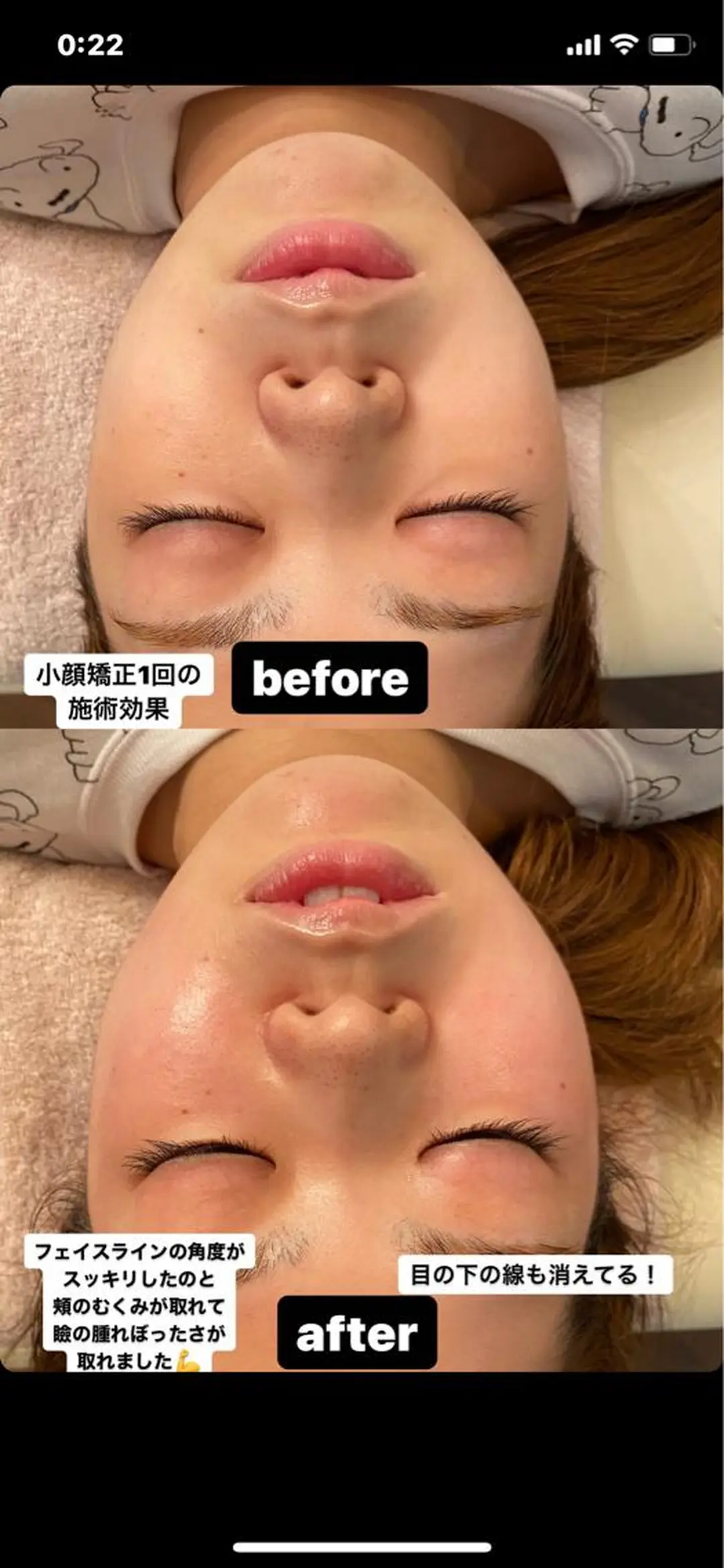 Aprecio[アプレシオ]整体・小顔矯正サロン所属・Aprecio [整体・小顔矯正]のエステ・リラクイメージ