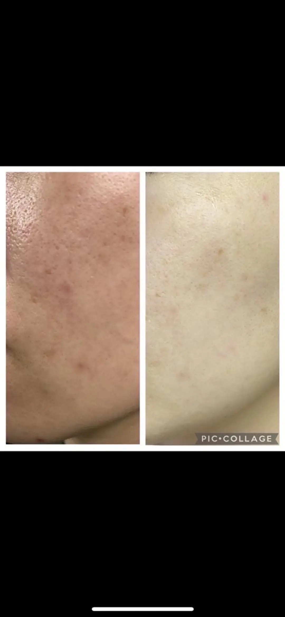 RinRin  津店のエステ・リラクイメージ