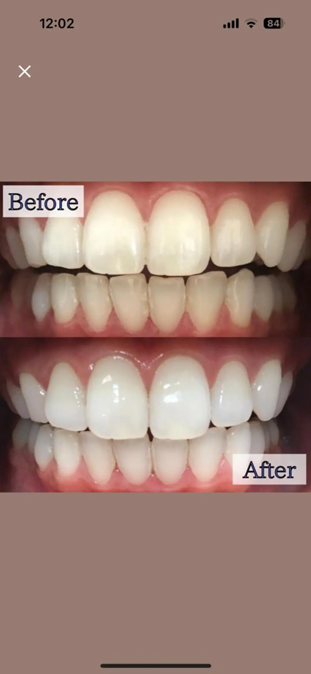 その他 LBSホワイトニング 銀座店💎店長浦和のその他イメージ