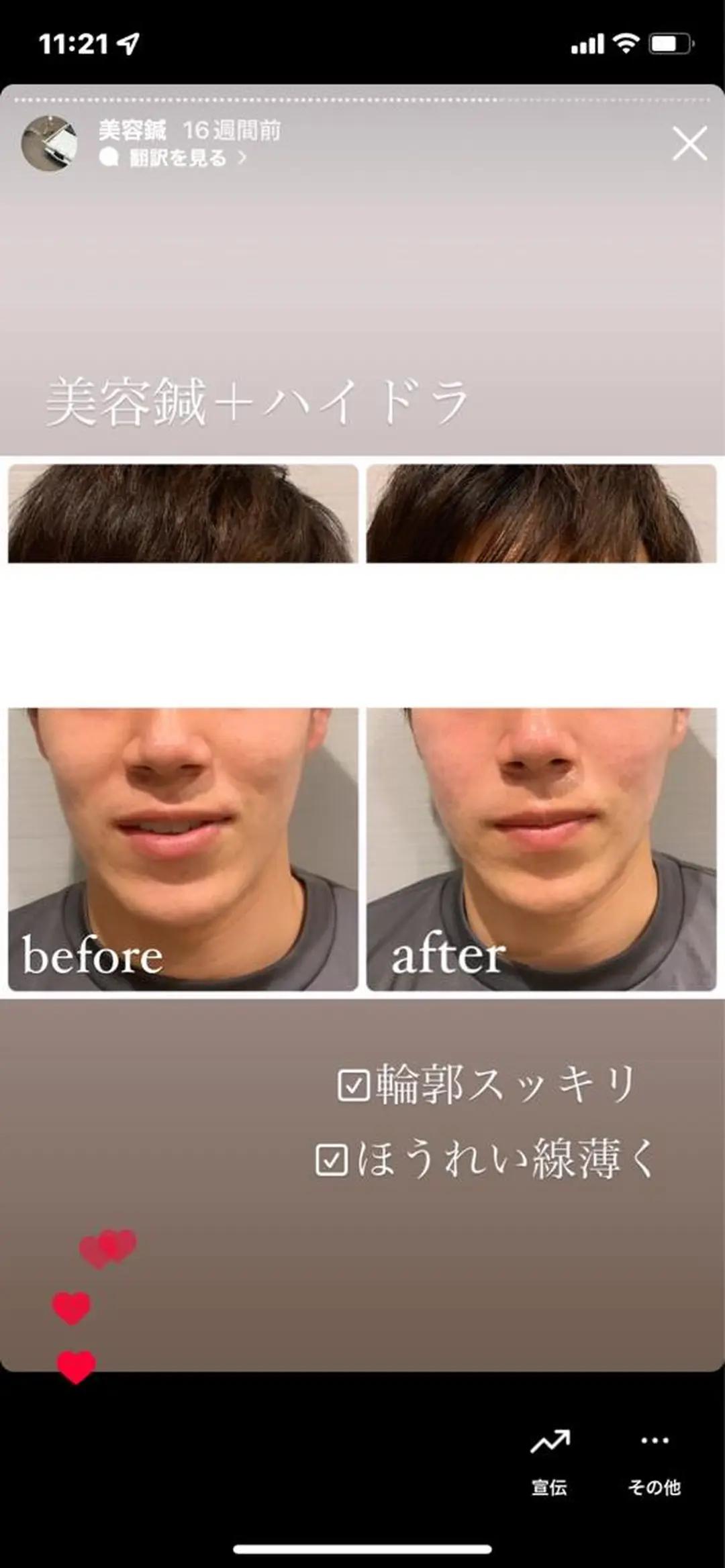 エステ リラク 種市 貴子のその他イメージ