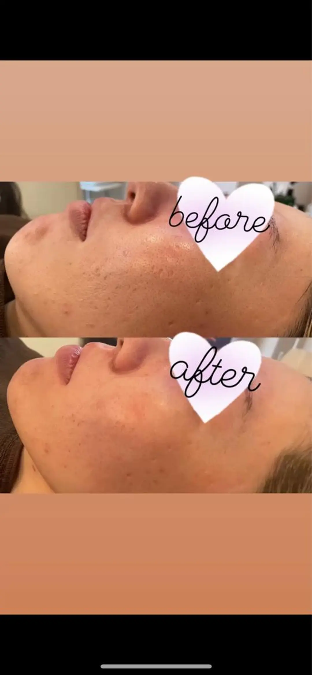 VERY VERY九条店所属・VERY VERY 九条店のエステ・リラクイメージ