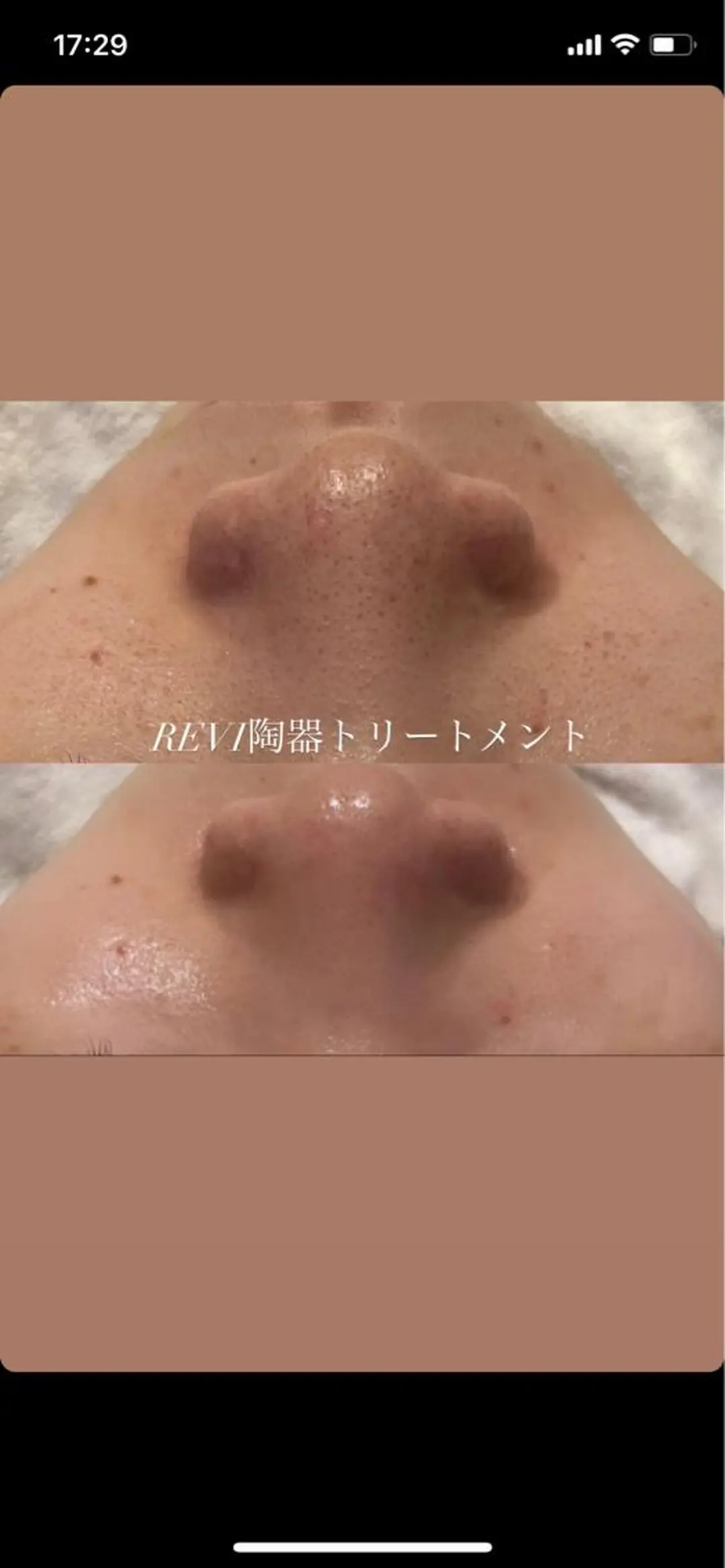 小顔&デコルテ Spa　“koti”のエステ・リラクイメージ