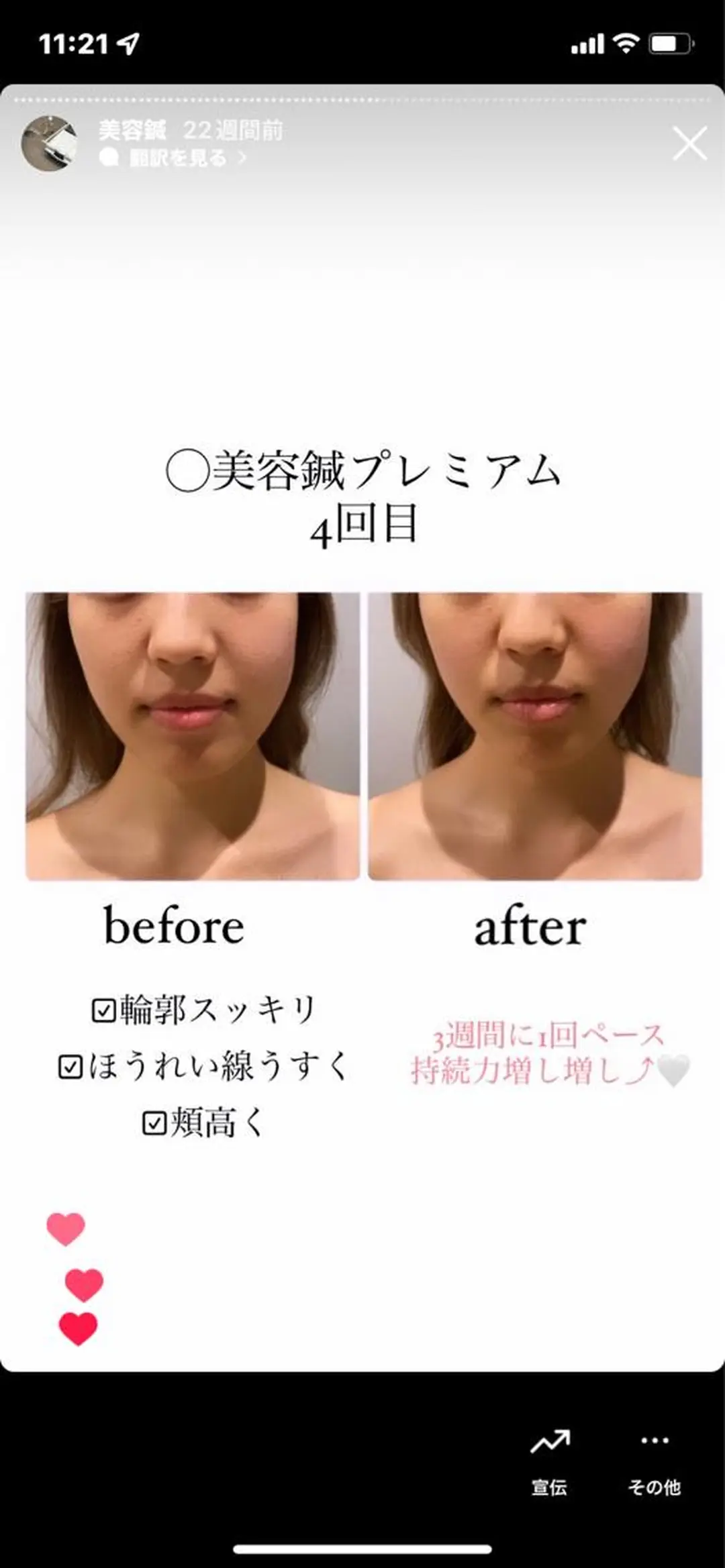 エステ リラク 種市 貴子のその他イメージ