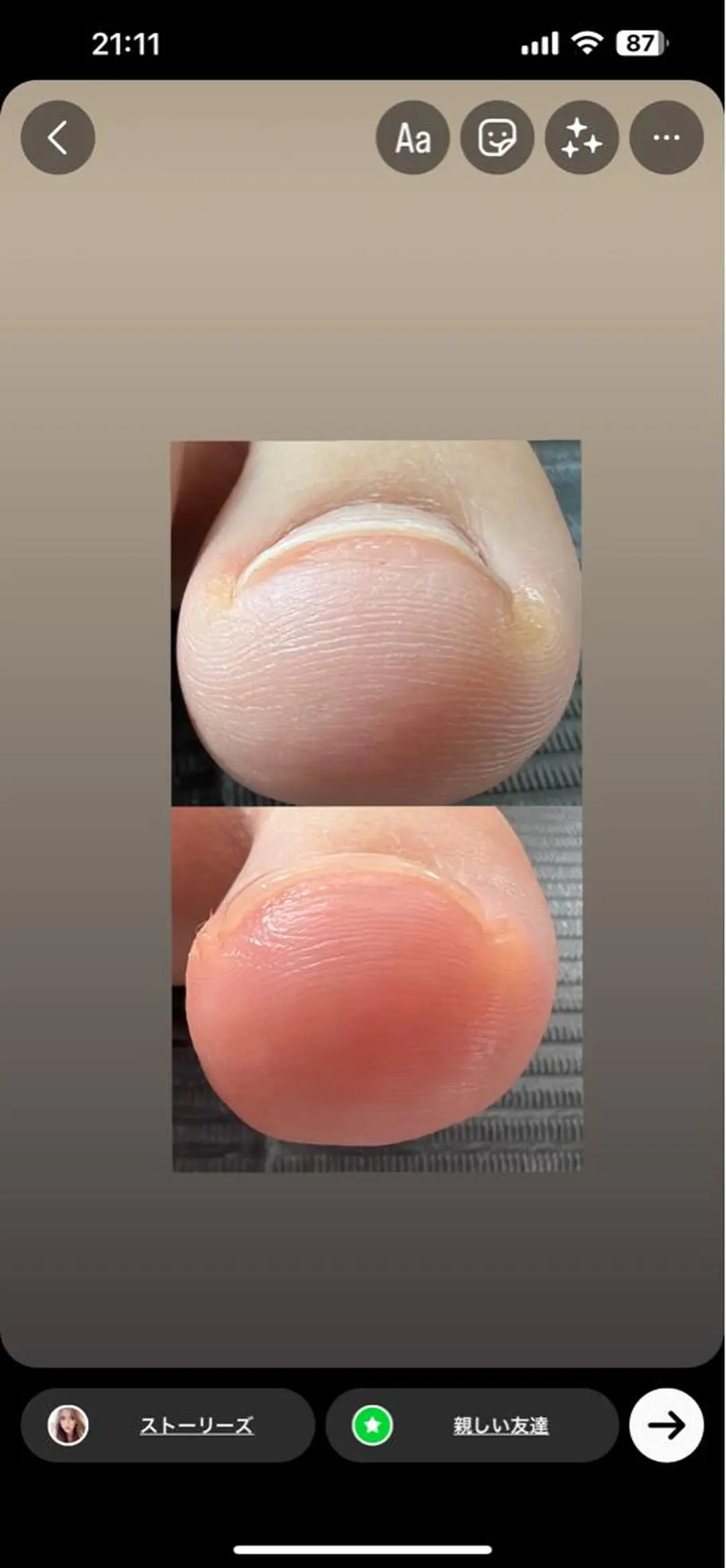 ネイル クリアネイル シェヌネイル JURAのネイルデザイン