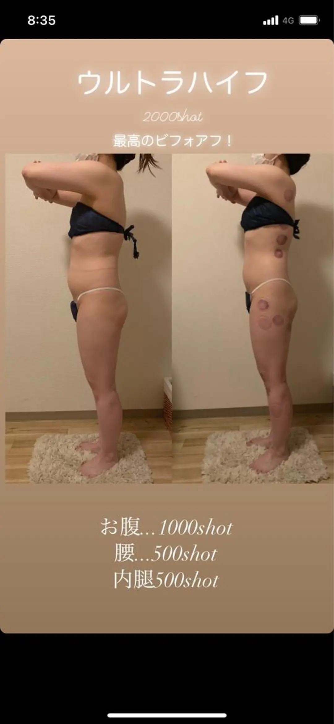 a  room salonのエステ・リラクイメージ