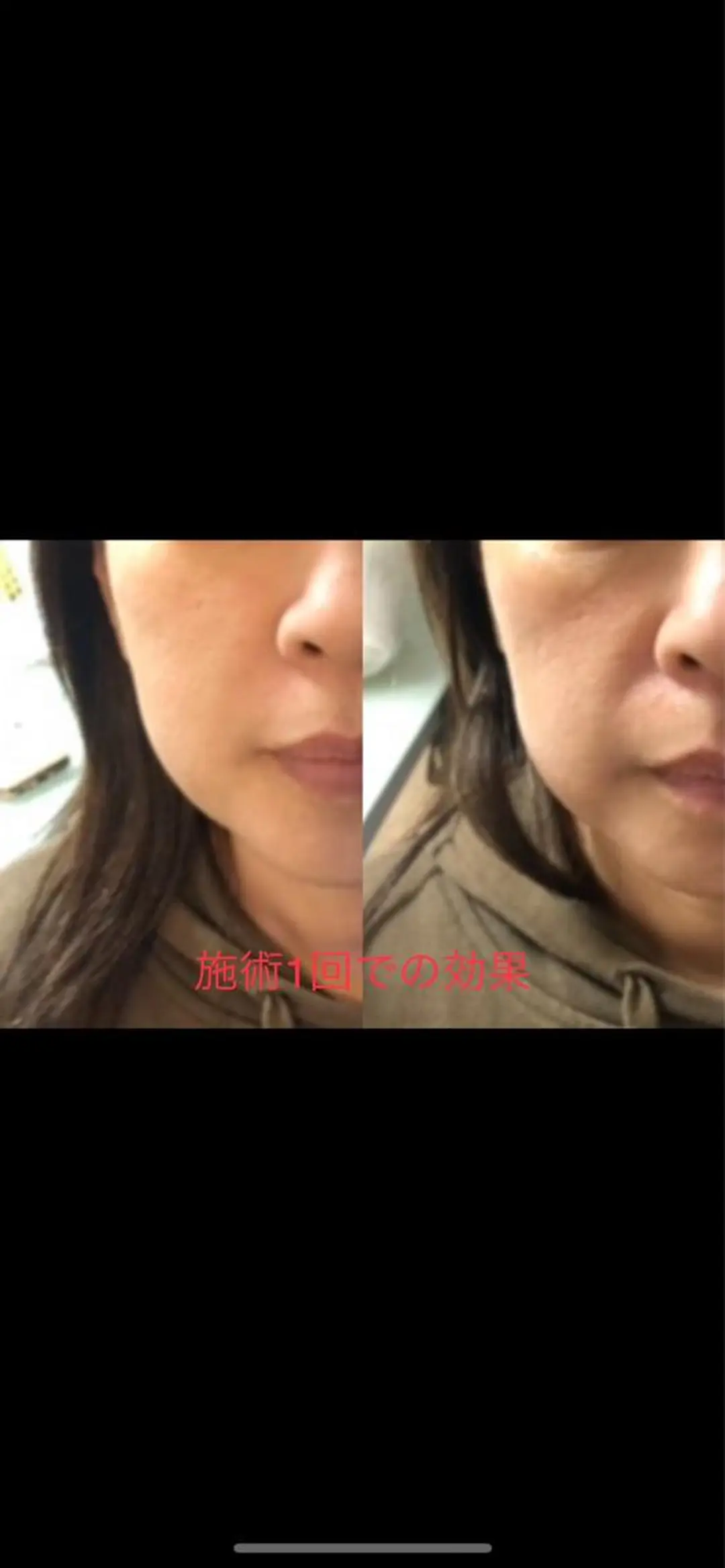 エステ 眠りの魔法使い HIGUCHIのエステ・リラクイメージ