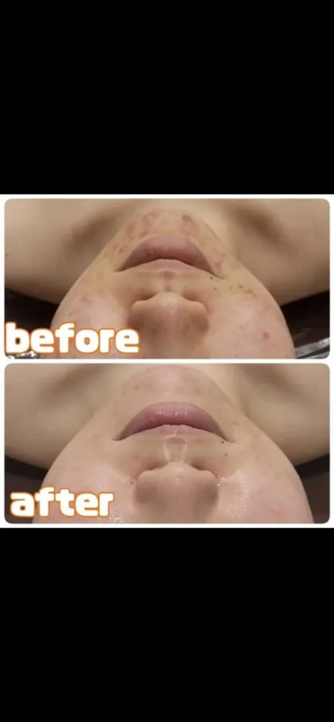 エステ リラク 🥀エステティック レイビス横浜　永🥀のエステ・リラクイメージ