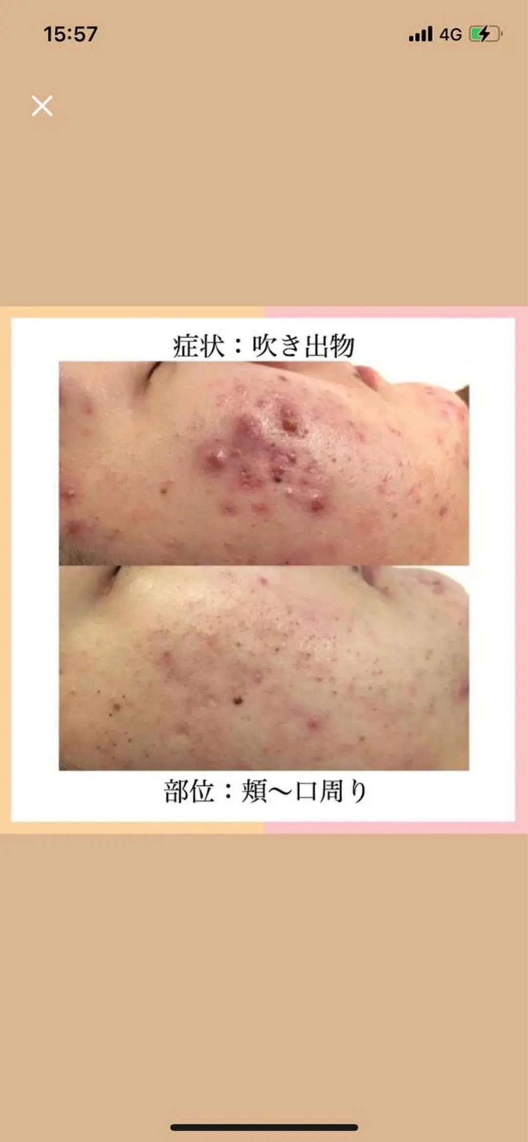 ロング カラー パーマ ヘアアレンジ メンズ キッズ ネイル マツエク・マツパ アイブロウ ニキビ特化型エステ 🍓最短で肌質改善のエステ・リラクイメージ